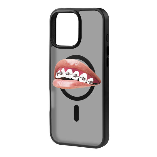 ORTHODONTIST-Blur Kılıf MagSafe Özellikli - iPhone 12