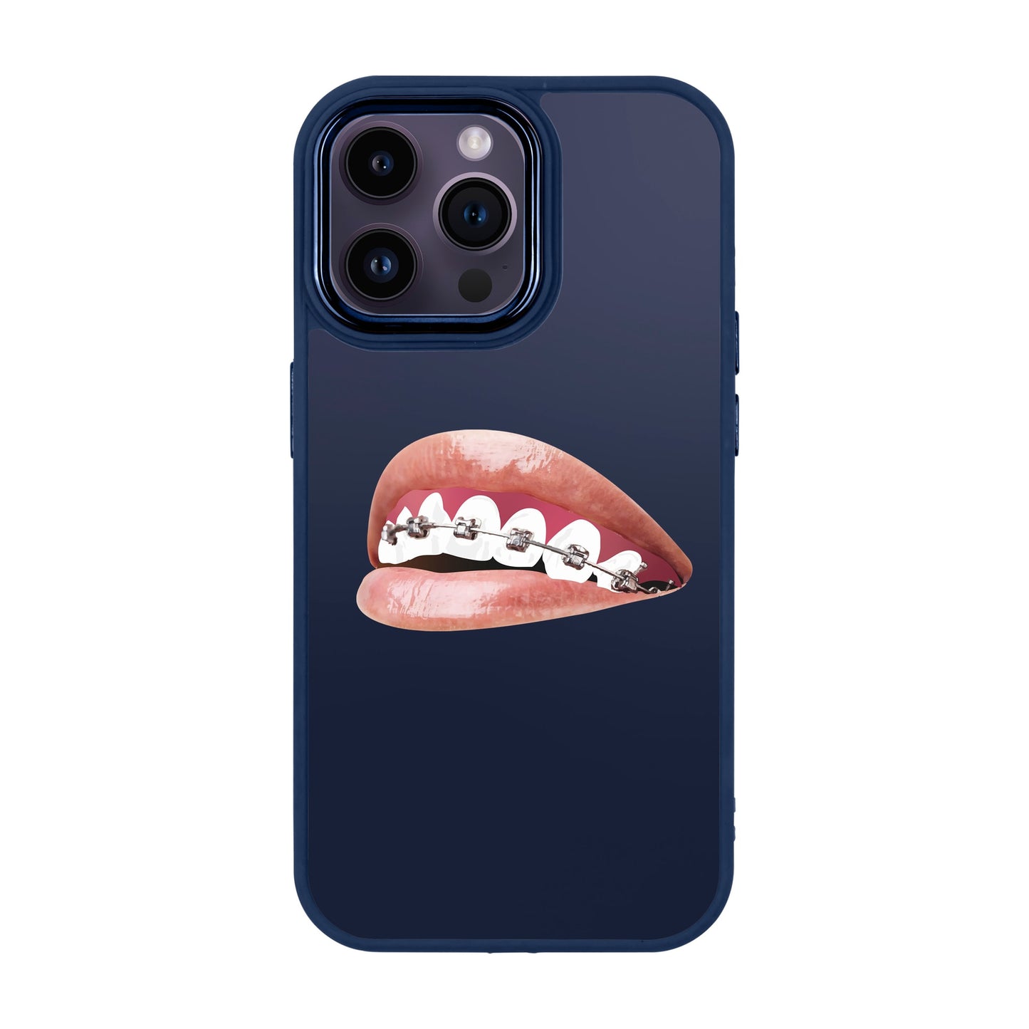 ORTHODONTIST-iPhone 14 Pro Max Proof Kılıf