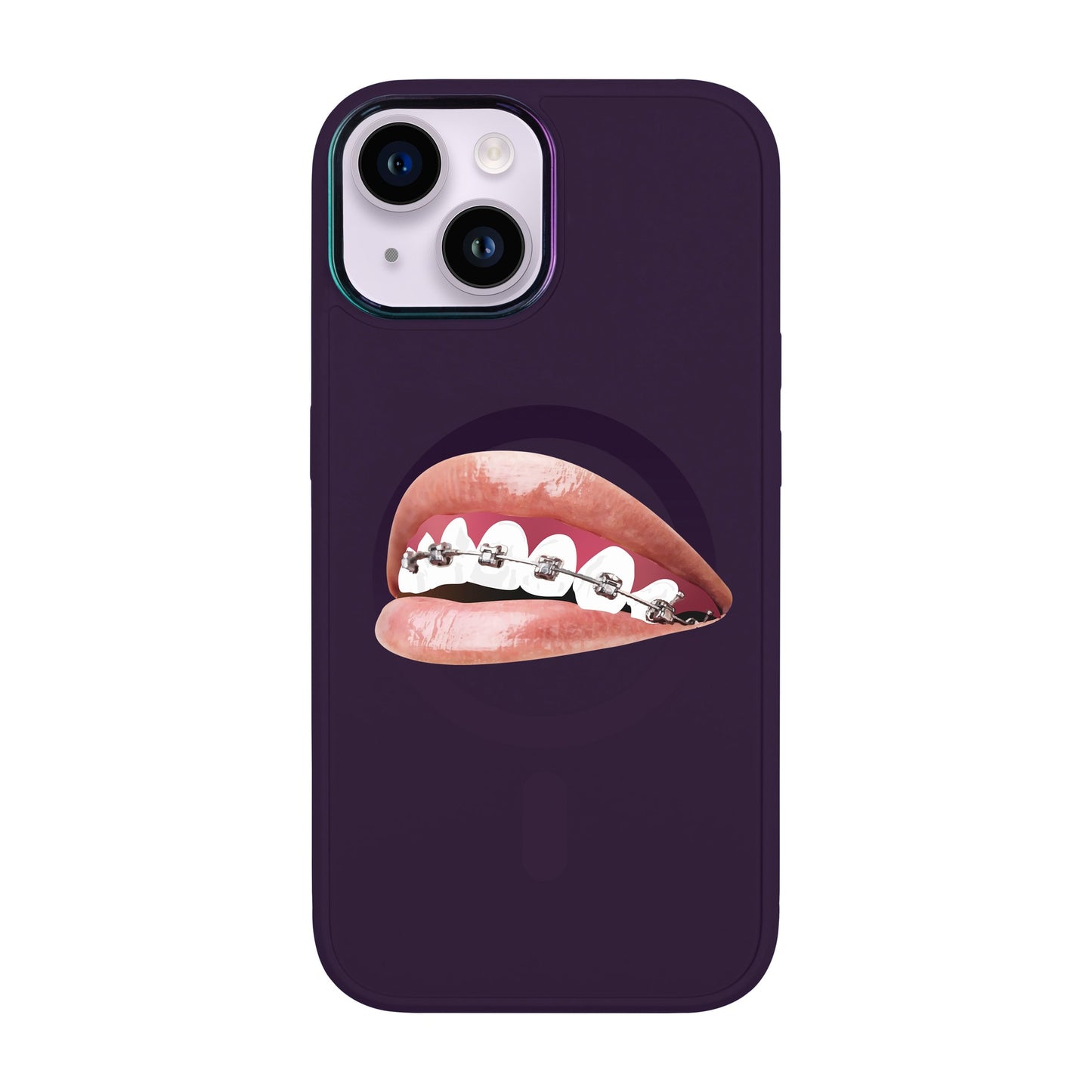 ORTHODONTİST-iPhone 12 Vigor Kılıf MagSafe Özellikli