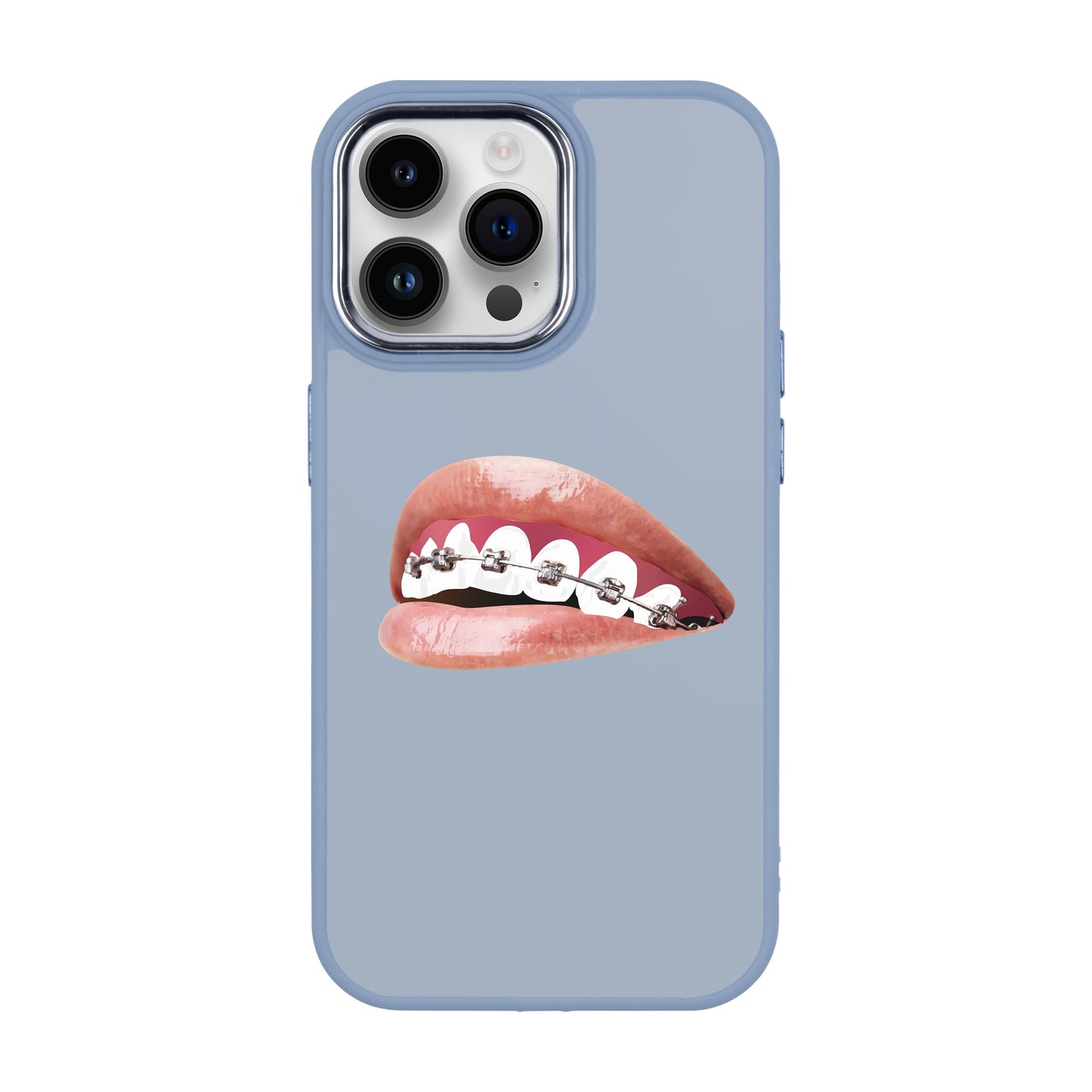 ORTHODONTIST-iPhone 14 Pro Max Proof Kılıf