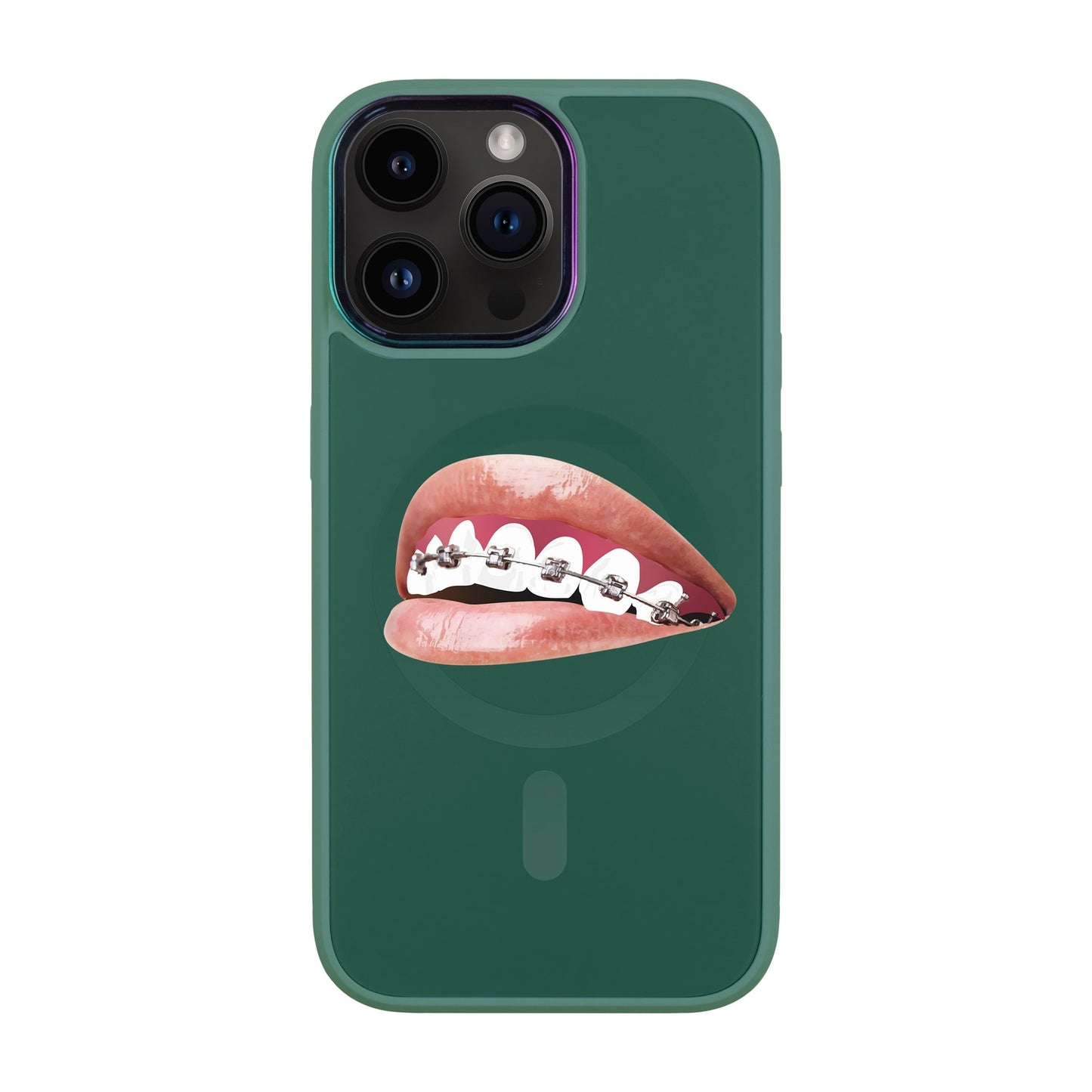 ORTHODONTİST-iPhone 13 Pro Max Vigor Kılıf MagSafe Özellikli