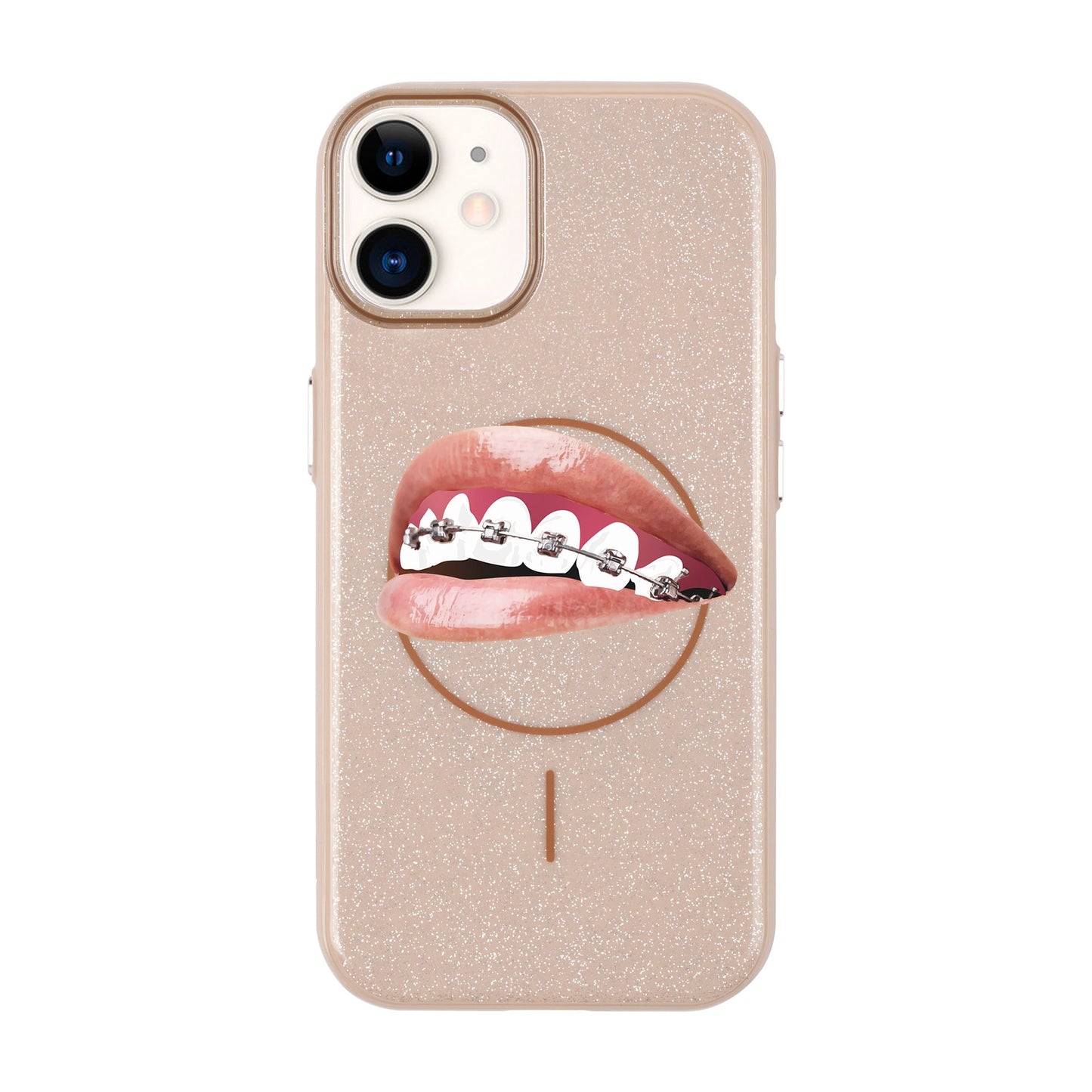 ORTHODONTIST-iPhone 11 Radiant Kılıf MagSafe Özellikli