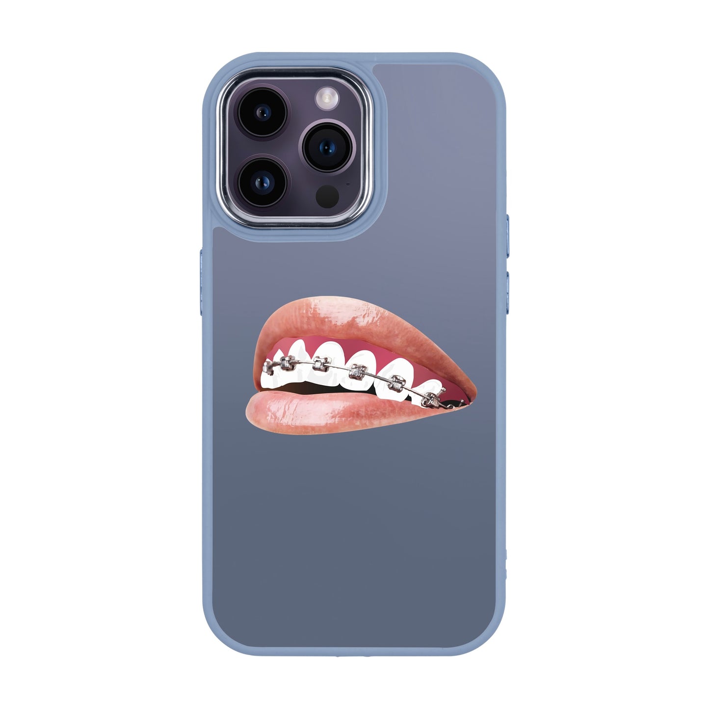 ORTHODONTIST-iPhone 14 Pro Max Proof Kılıf