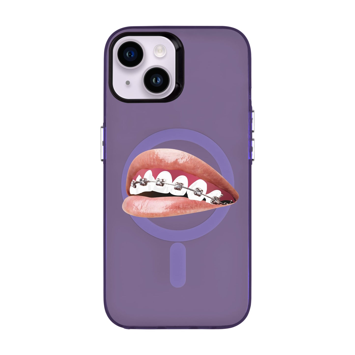 ORTHODONTIST-iPhone 14 Hold Kılıf MagSafe Özellikli