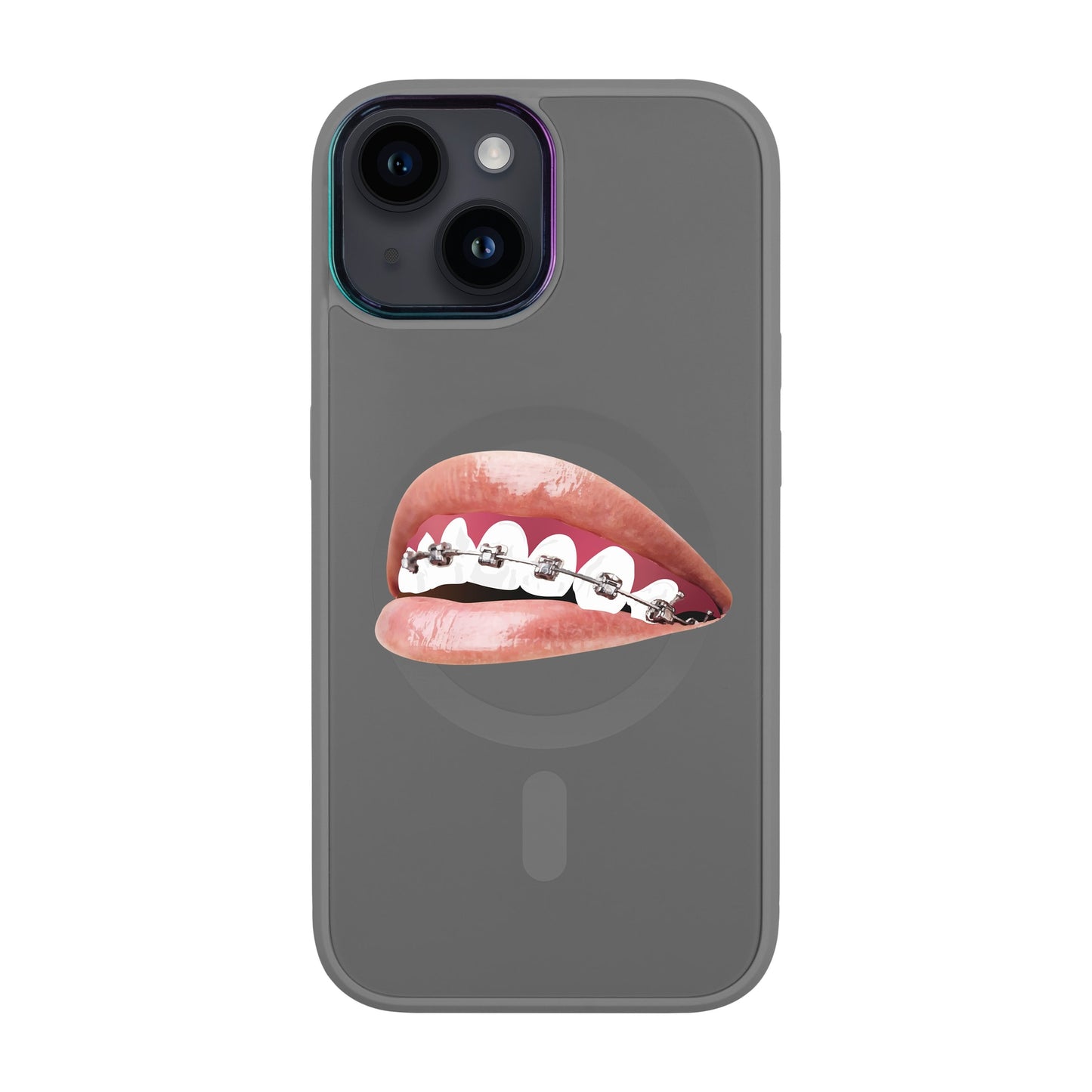 ORTHODONTİST-iPhone 12 Vigor Kılıf MagSafe Özellikli