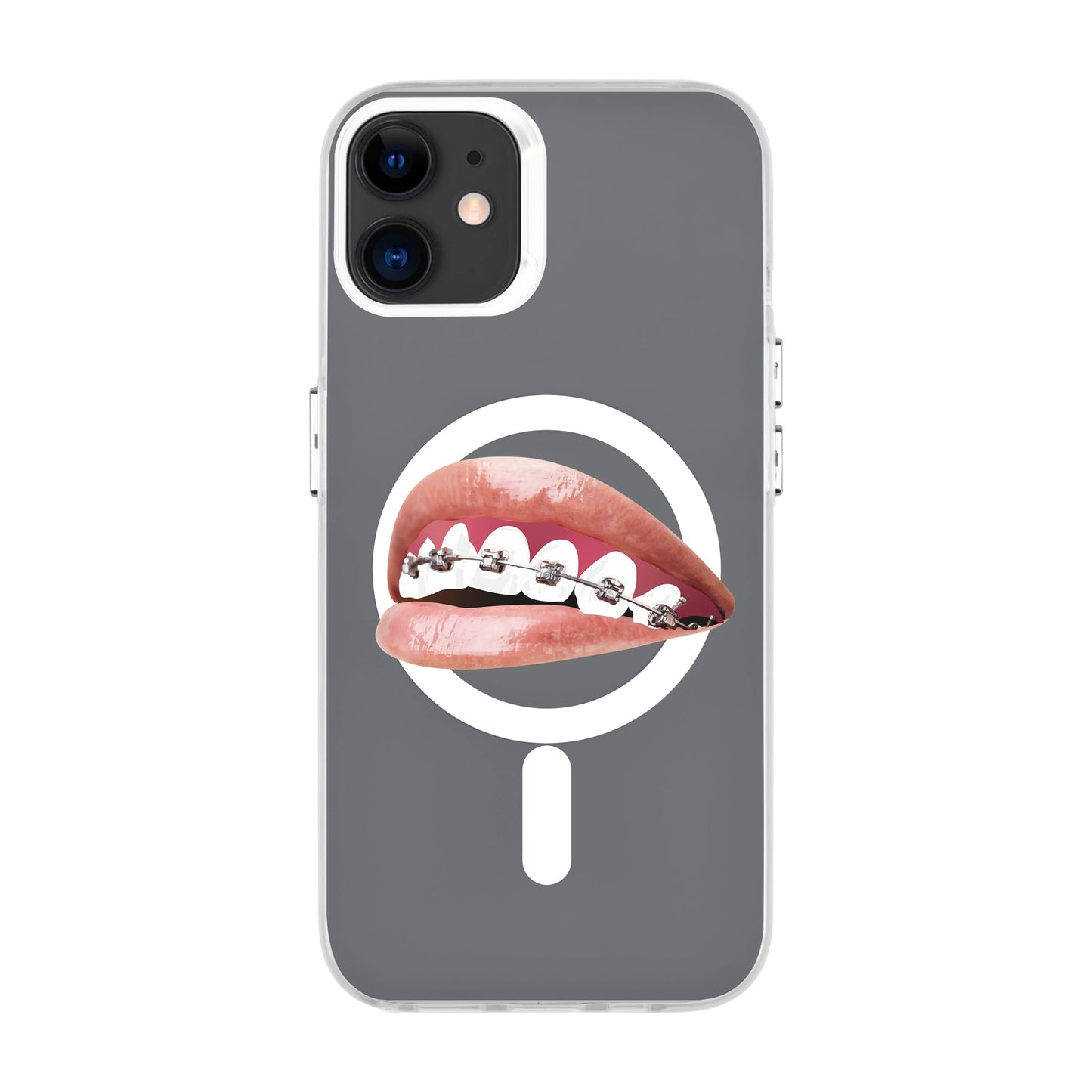 ORTHODONTIST-iPhone 11 Hold Kılıf MagSafe Özellikli
