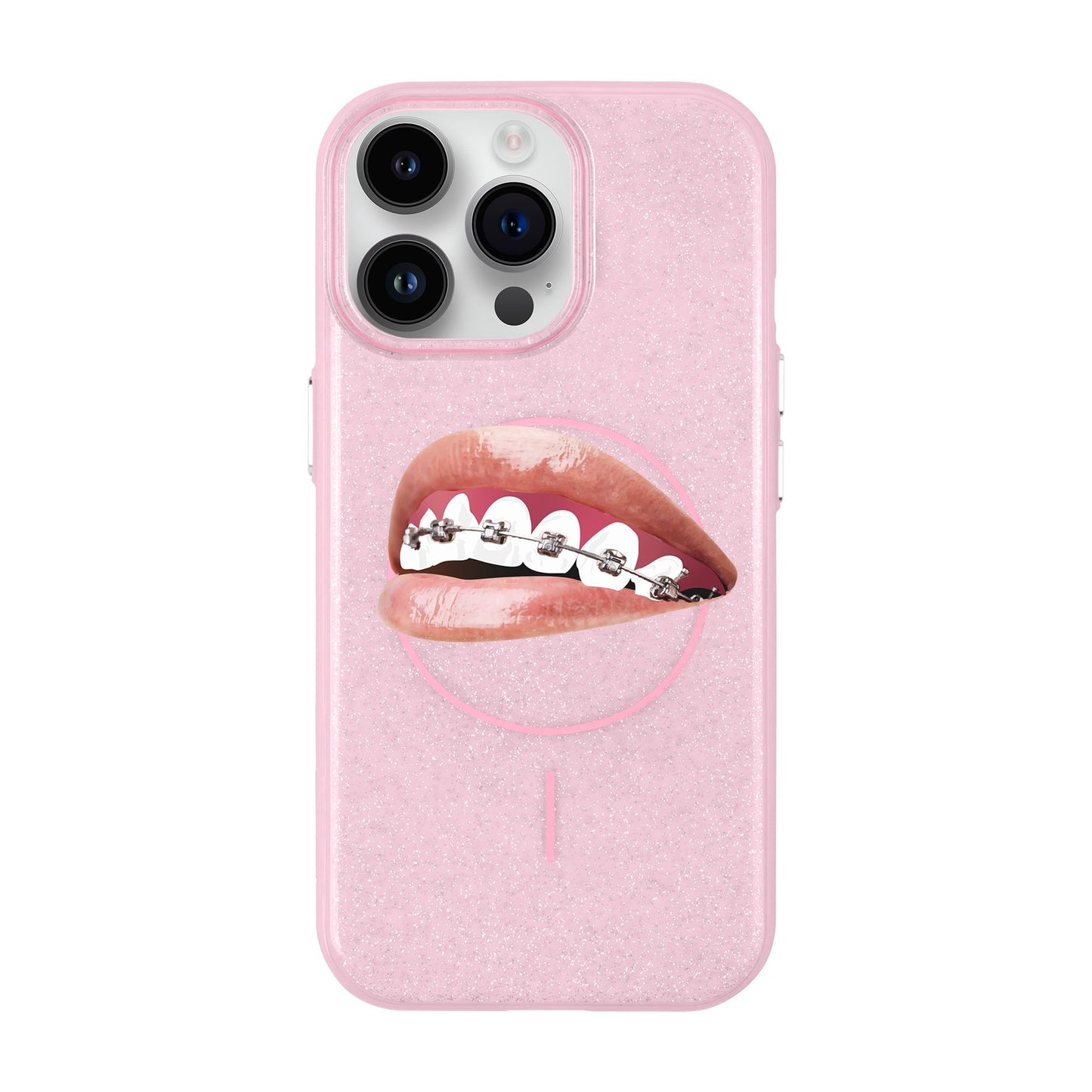 ORTHODONTIST-iPhone 14 Pro Max Radiant Kılıf MagSafe Özellikli