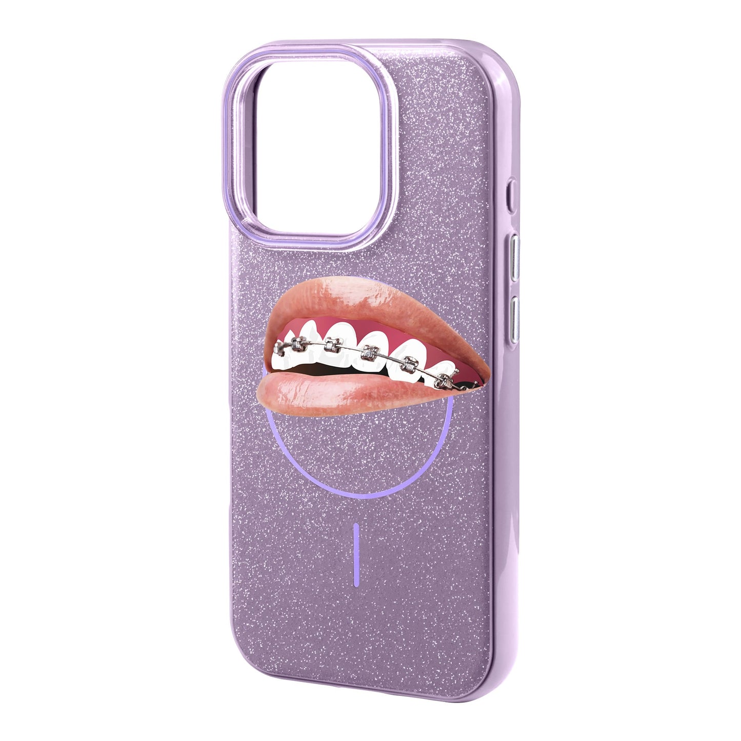 ORTHODONTIST-iPhone 16 Pro Max Radiant Kılıf MagSafe Özellikli