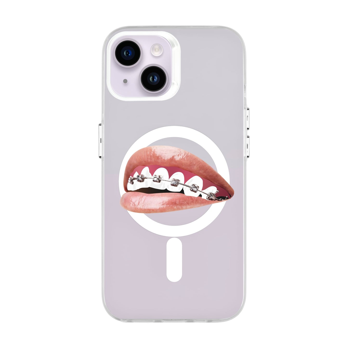 ORTHODONTIST-iPhone 14 Hold Kılıf MagSafe Özellikli
