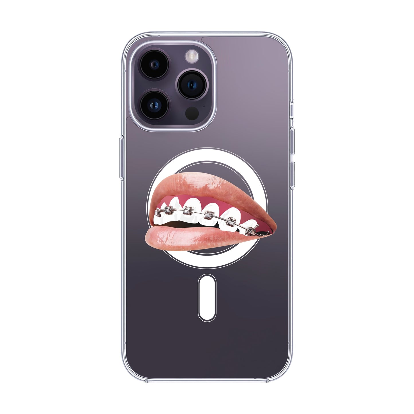 ORTHODONTIST-iPhone 14 Pro Max Solid Kılıf MagSafe Özellikli