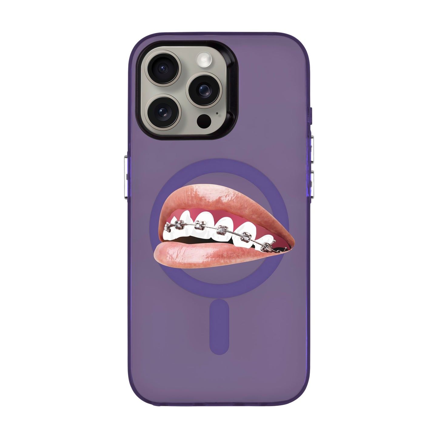 ORTHODONTIST-iPhone 15 Pro Max Hold Kılıf MagSafe Özellikli