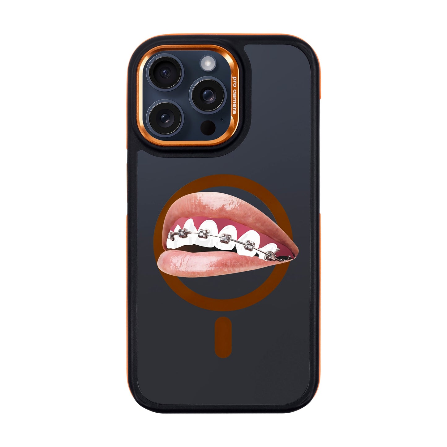 ORTHODONTIST-iPhone 15 Pro Max Dark Kılıf MagSafe Özellikli