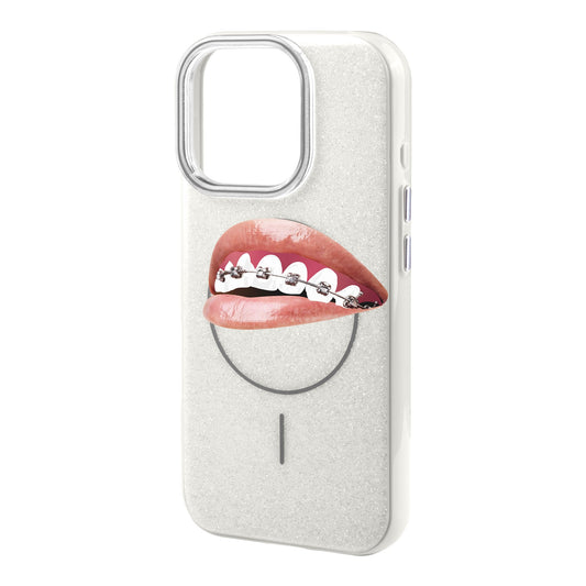 ORTHODONTIST-Radiant Kılıf MagSafe Özellikli - iPhone 16 Plus