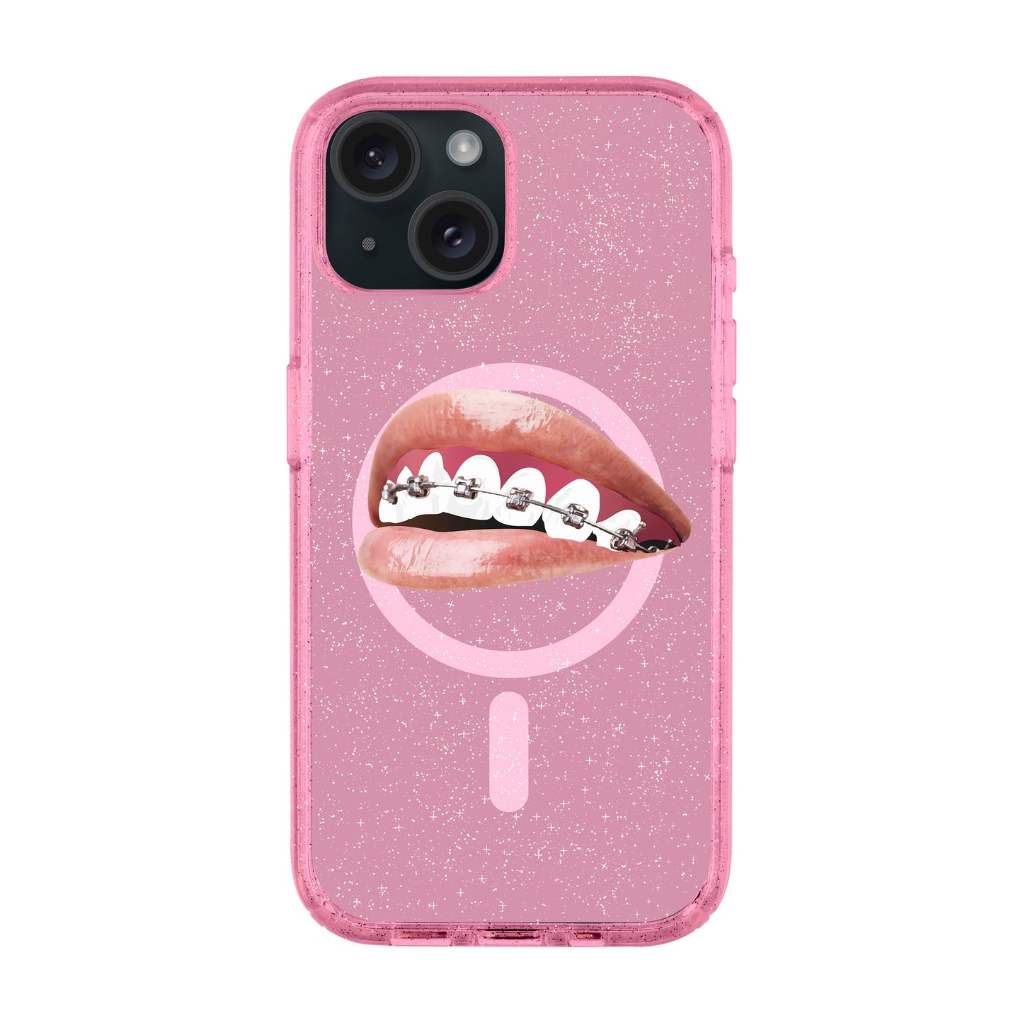 ORTHODONTIST-iPhone 15 Plus Shiny Kılıf MagSafe Özellikli