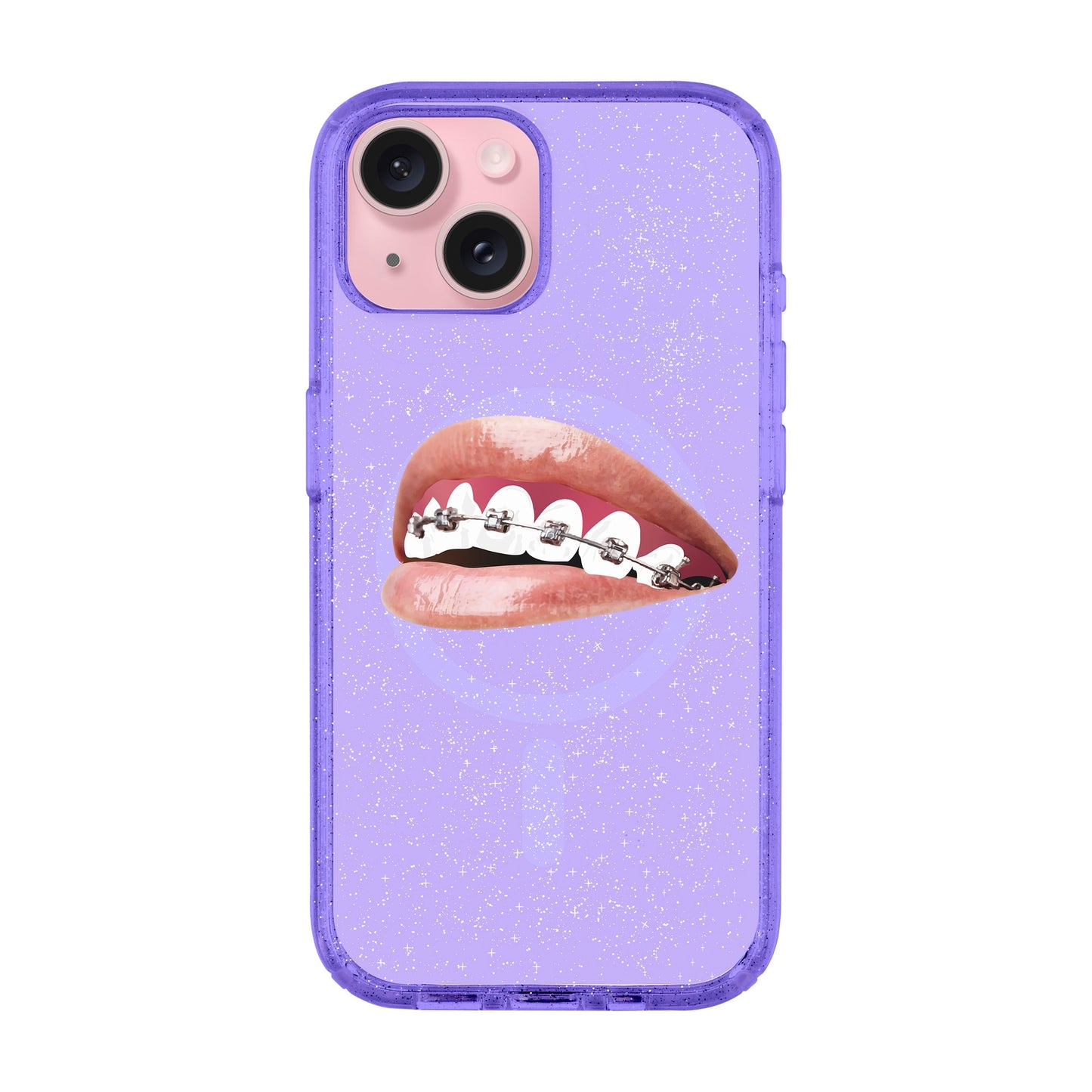 ORTHODONTIST-iPhone 15 Plus Shiny Kılıf MagSafe Özellikli