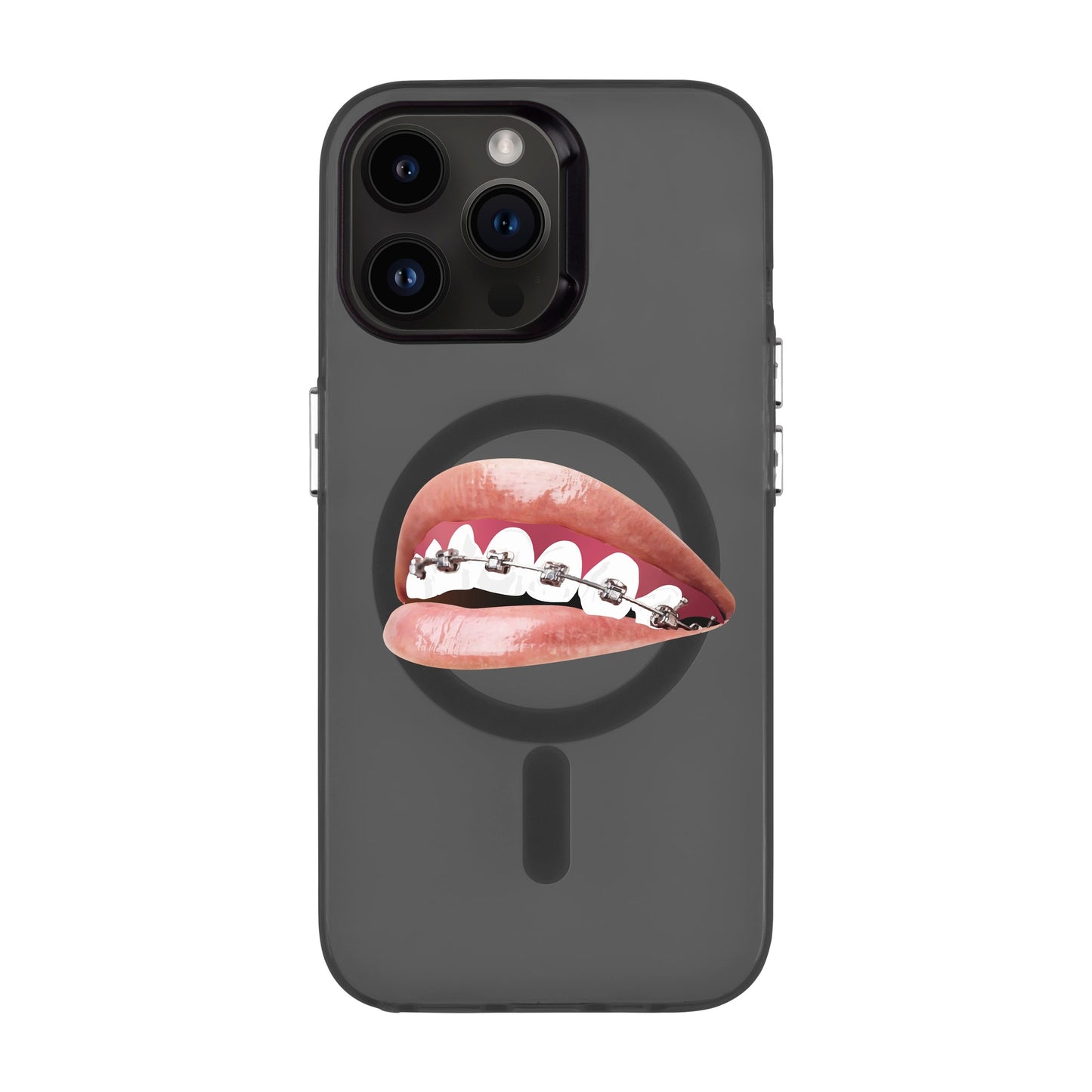ORTHODONTIST-iPhone 14 Pro Max Hold Kılıf MagSafe Özellikli