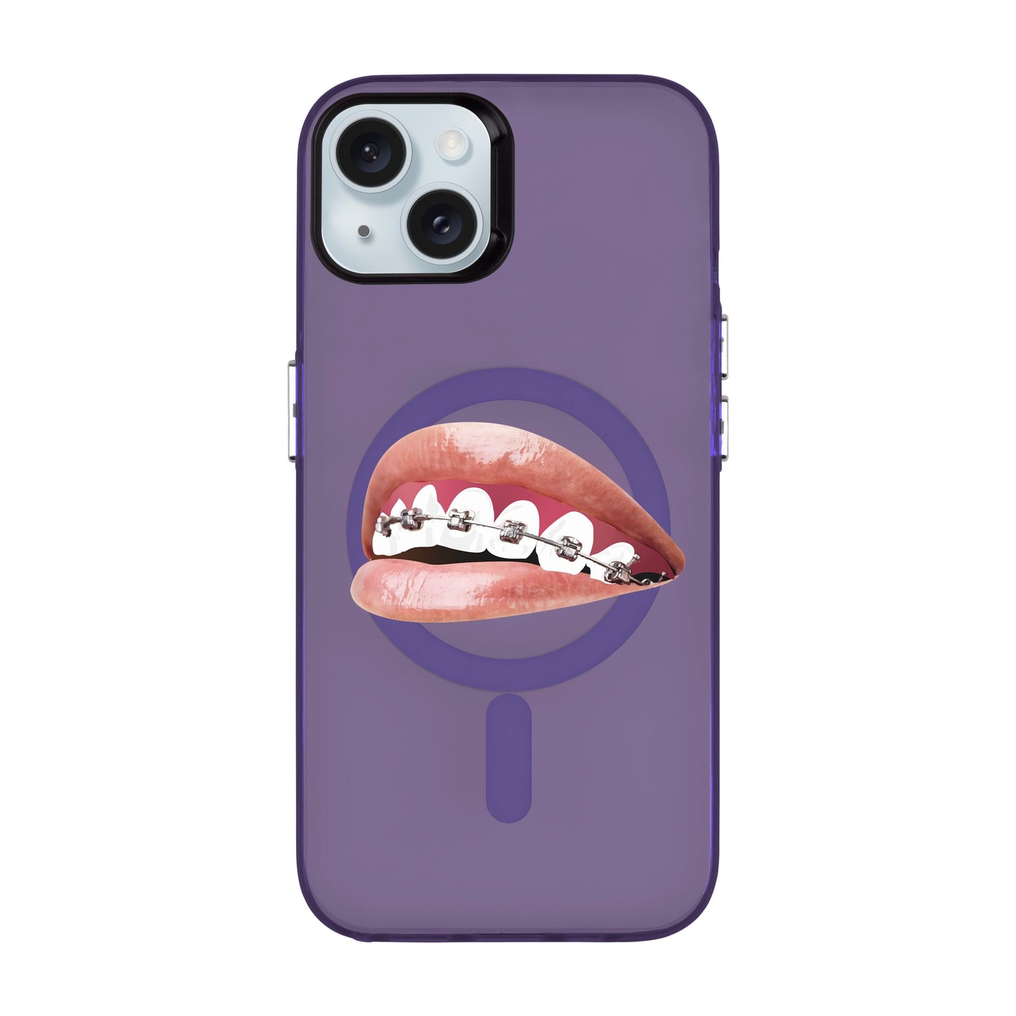 ORTHODONTIST-iPhone 15 Plus Hold Kılıf MagSafe Özellikli