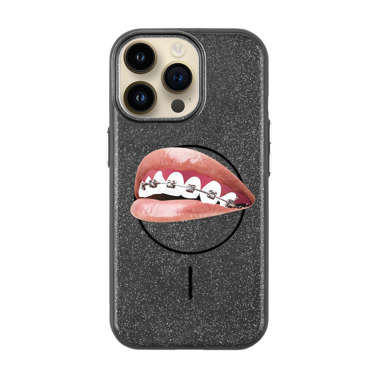 ORTHODONTIST-iPhone 14 Pro Max Radiant Kılıf MagSafe Özellikli
