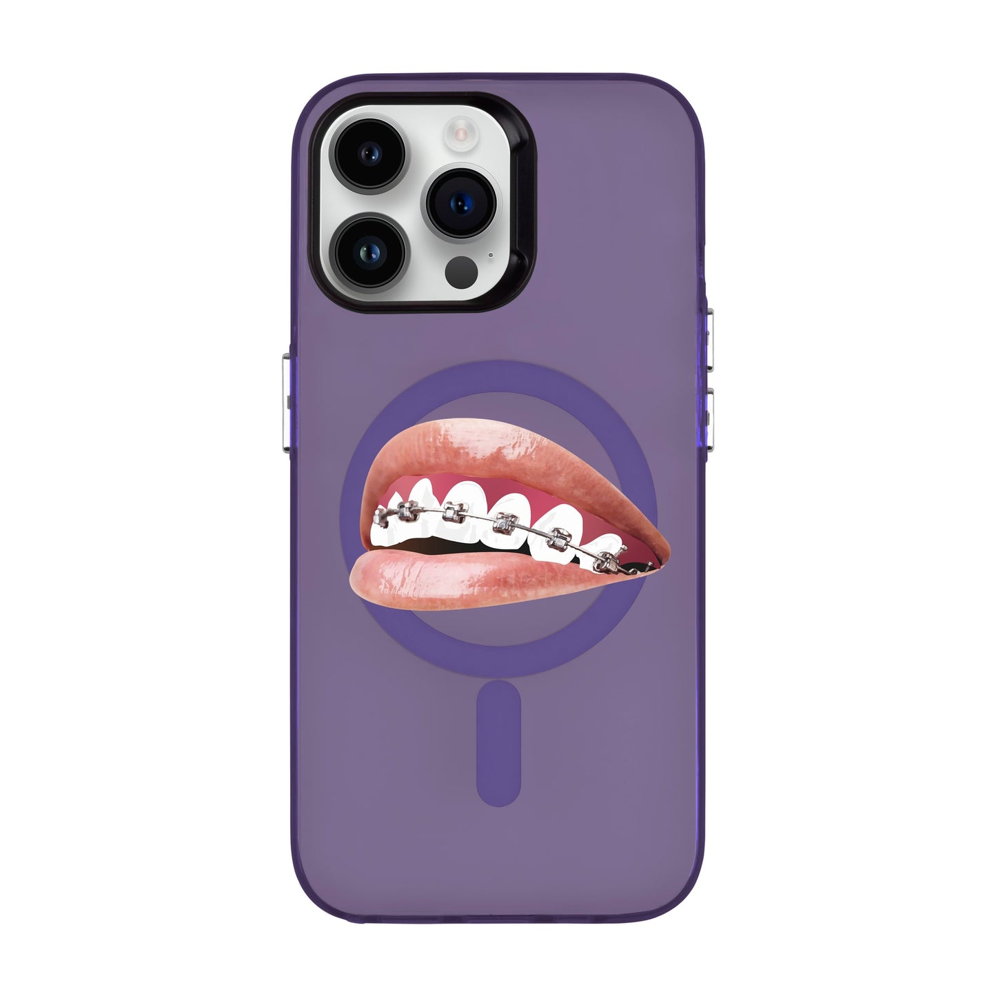 ORTHODONTIST-iPhone 14 Pro Max Hold Kılıf MagSafe Özellikli