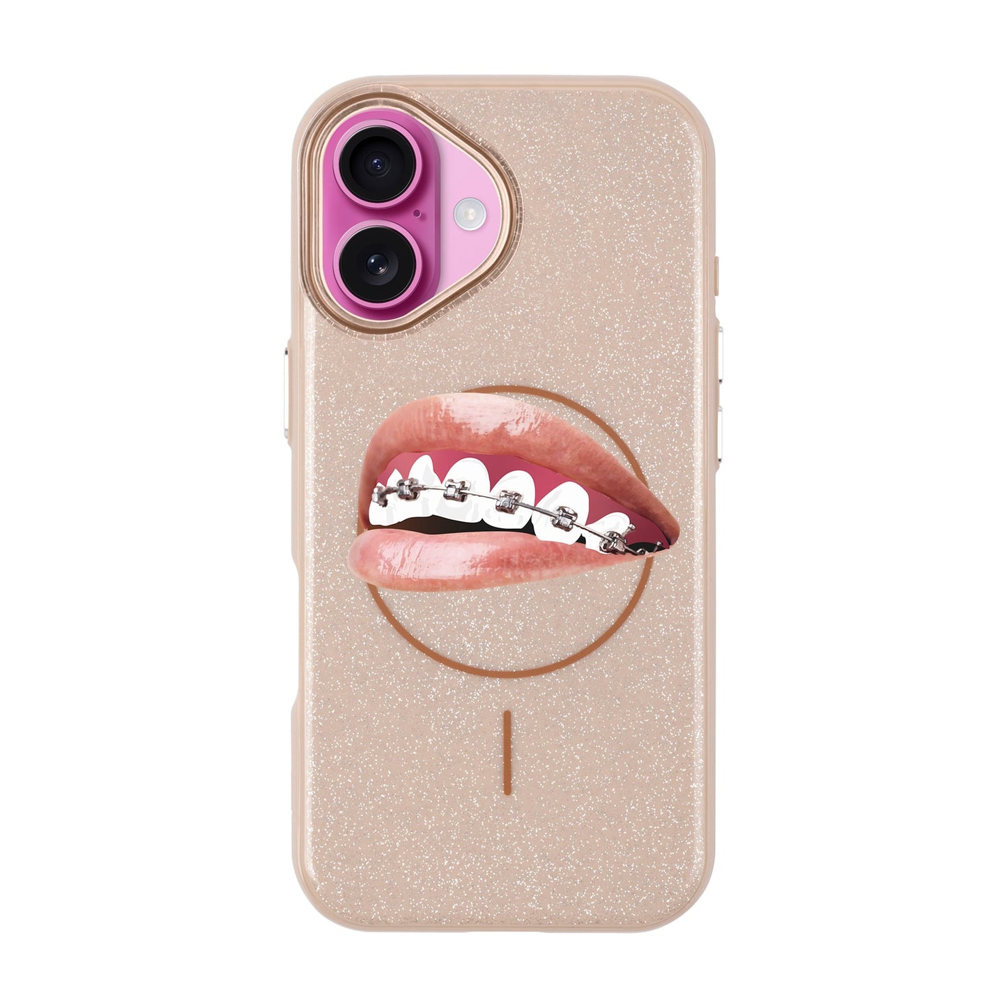 ORTHODONTIST-iPhone 16 Radiant Kılıf MagSafe Özellikli