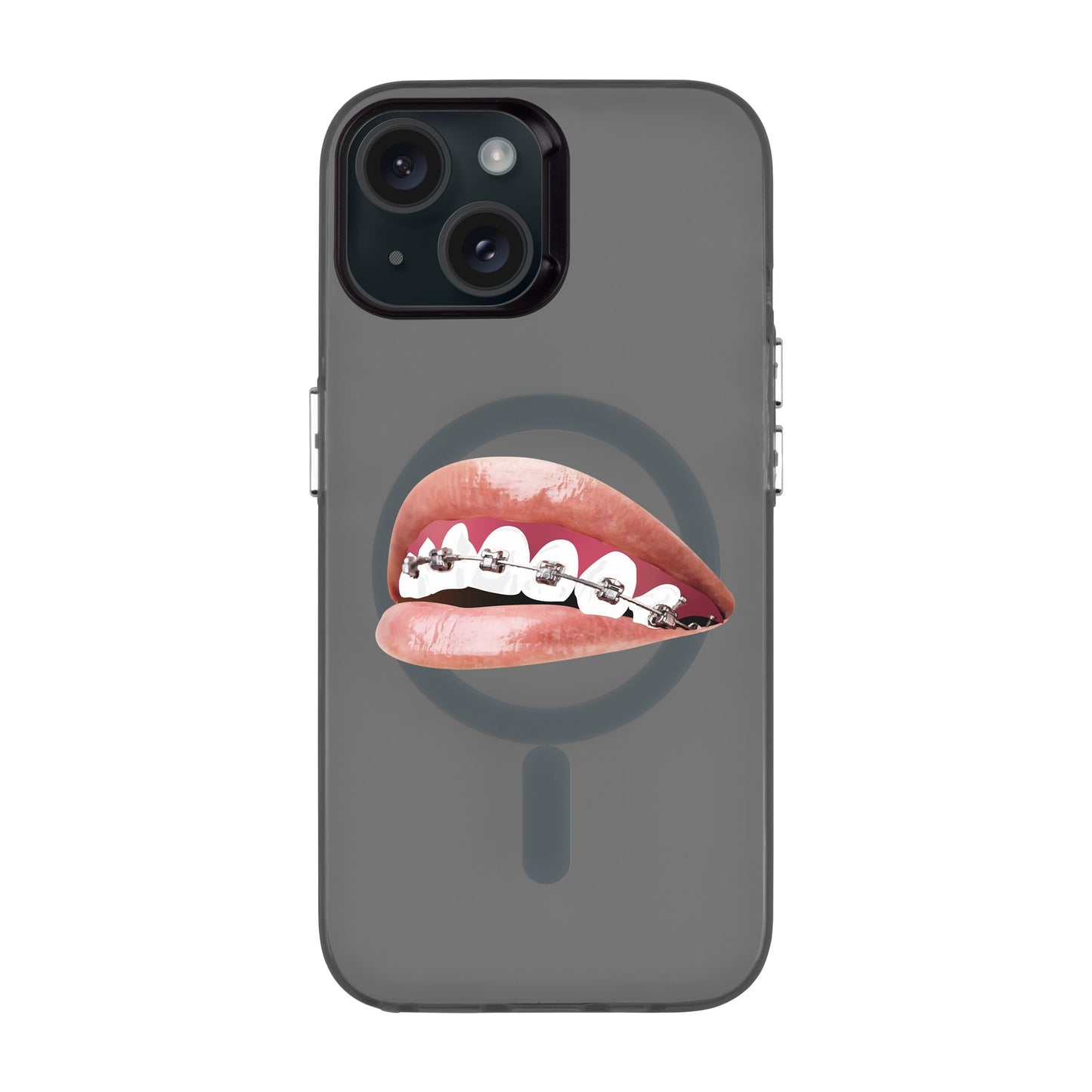 ORTHODONTIST-iPhone 15 Hold Kılıf MagSafe Özellikli