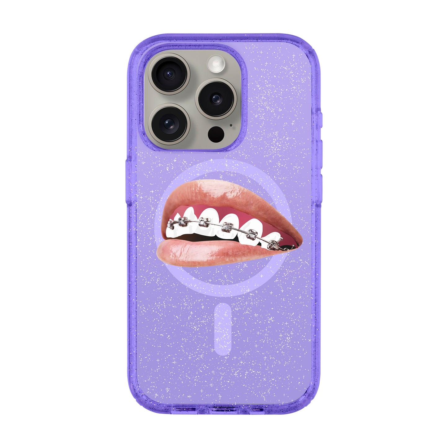ORTHODONTIST-iPhone 15 Pro Shiny Kılıf MagSafe Özellikli