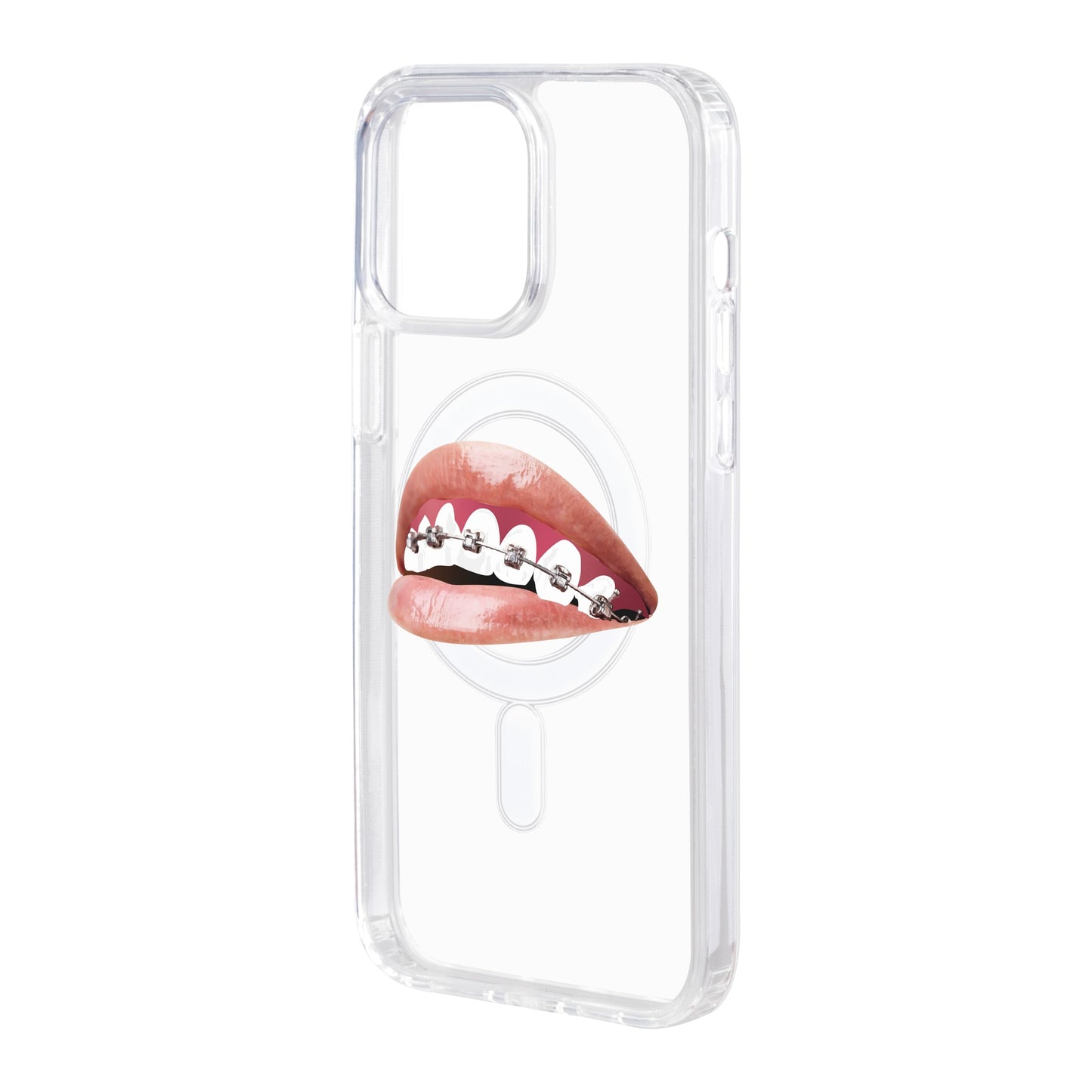 ORTHODONTIST-iPhone 13 Pro Max Solid Kılıf MagSafe Özellikli
