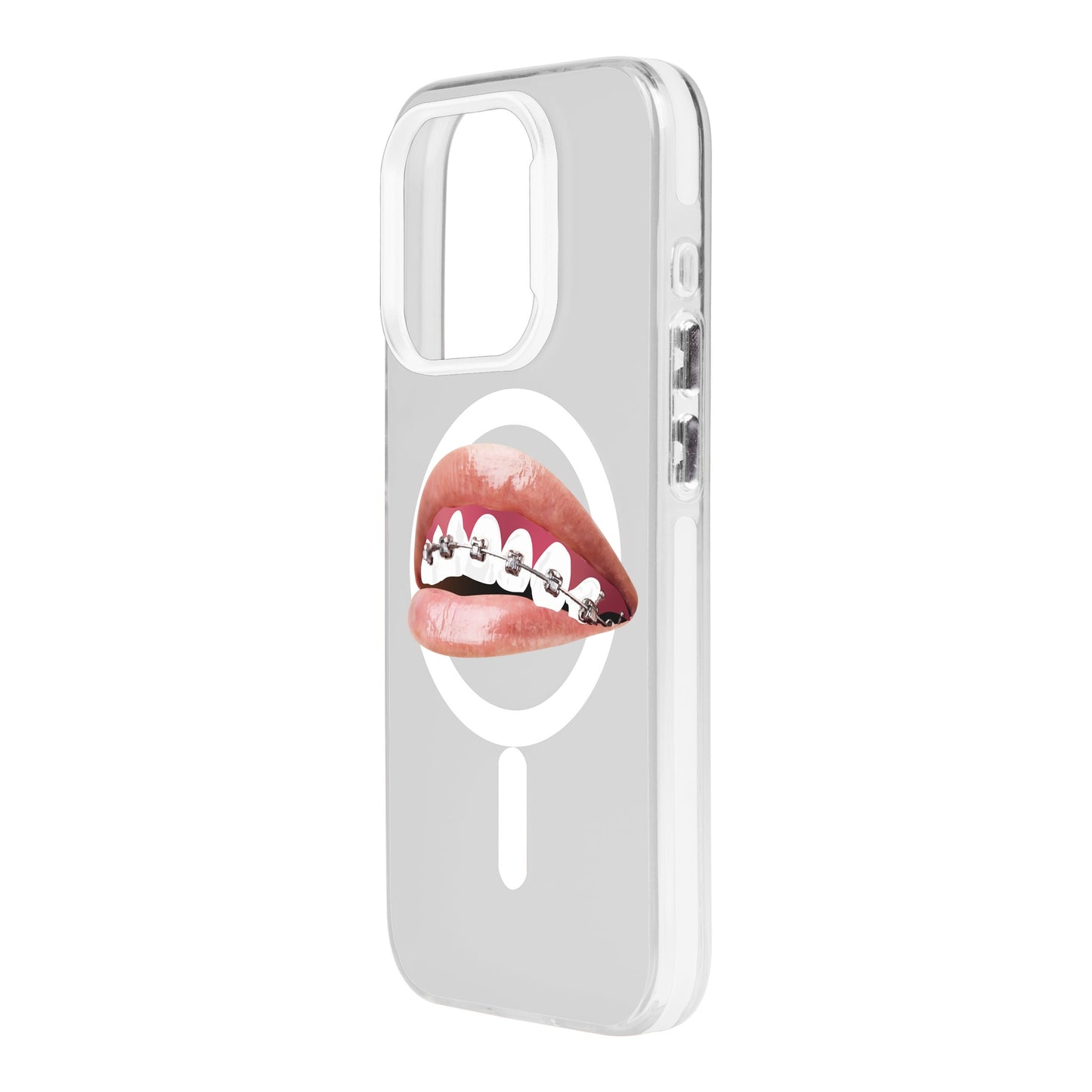 ORTHODONTIST-iPhone 15 Pro Hold Kılıf MagSafe Özellikli