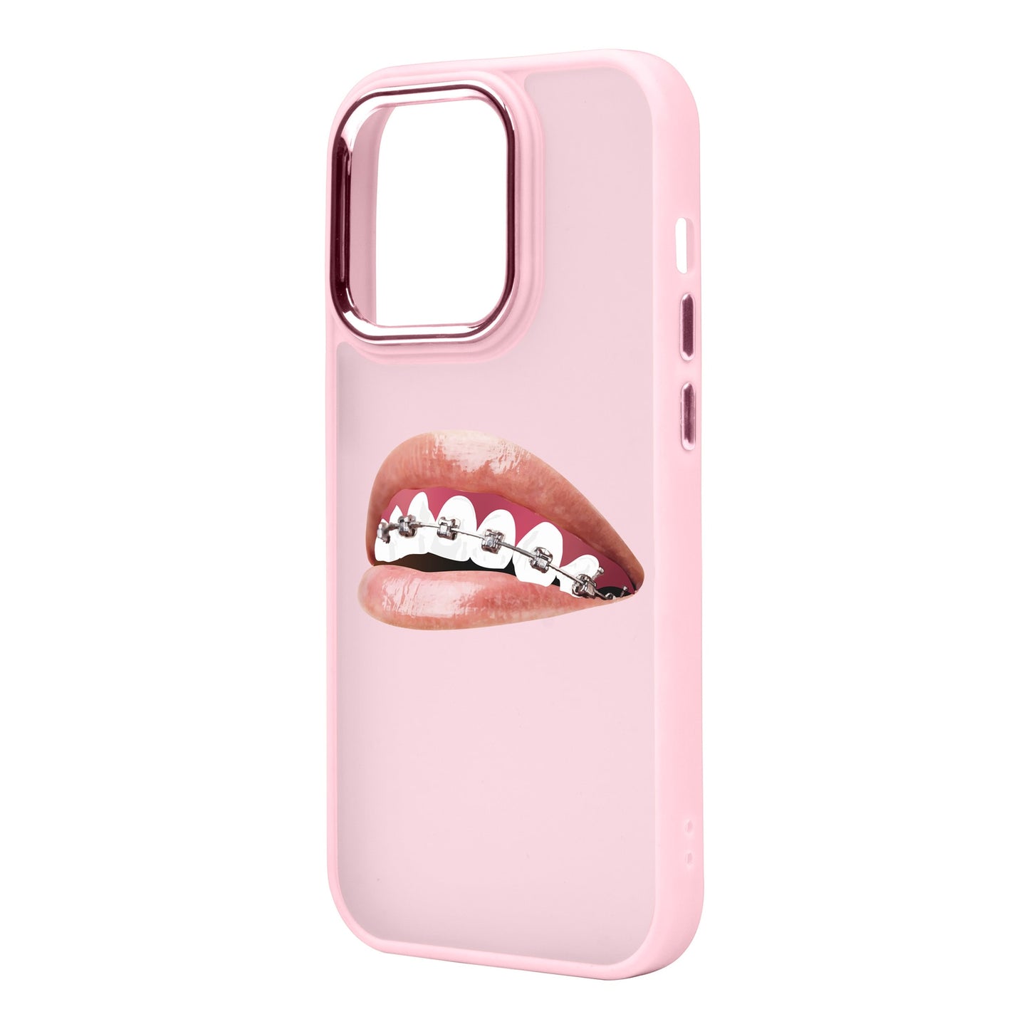ORTHODONTIST-iPhone 14 Pro Max Proof Kılıf