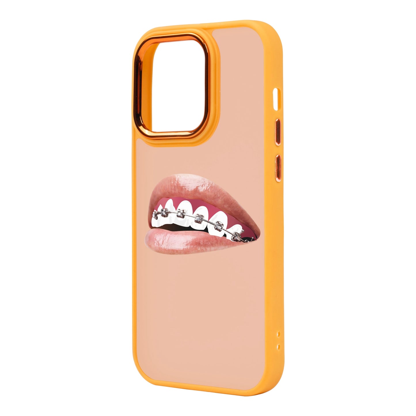 ORTHODONTIST-iPhone 14 Pro Max Proof Kılıf