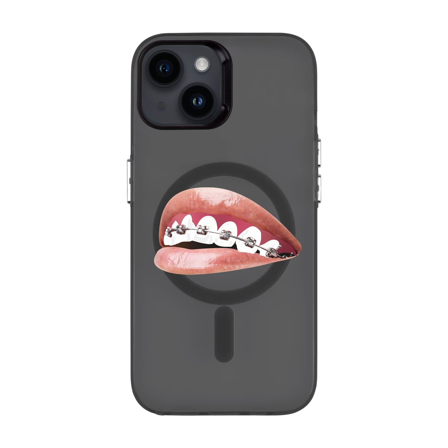ORTHODONTIST-iPhone 14 Hold Kılıf MagSafe Özellikli