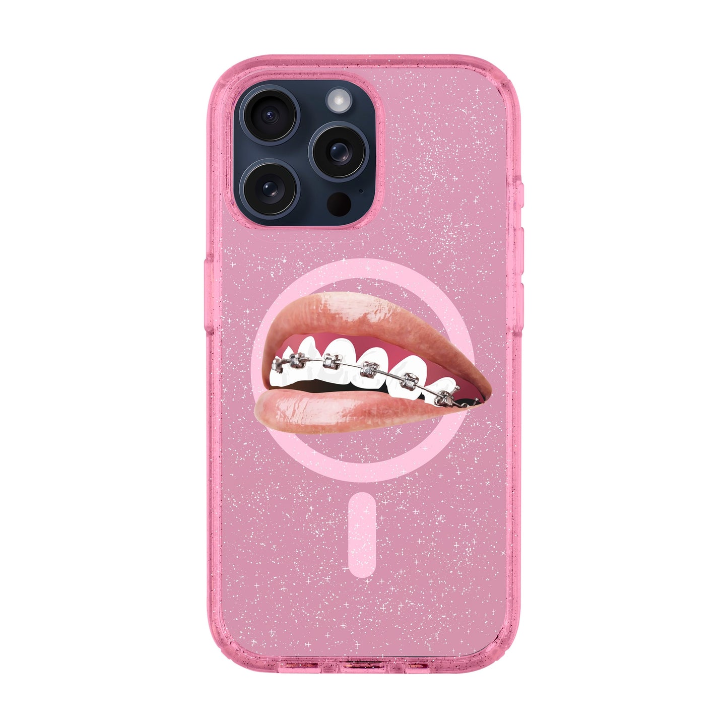 ORTHODONTIST-iPhone 15 Pro Max Shiny Kılıf MagSafe Özellikli