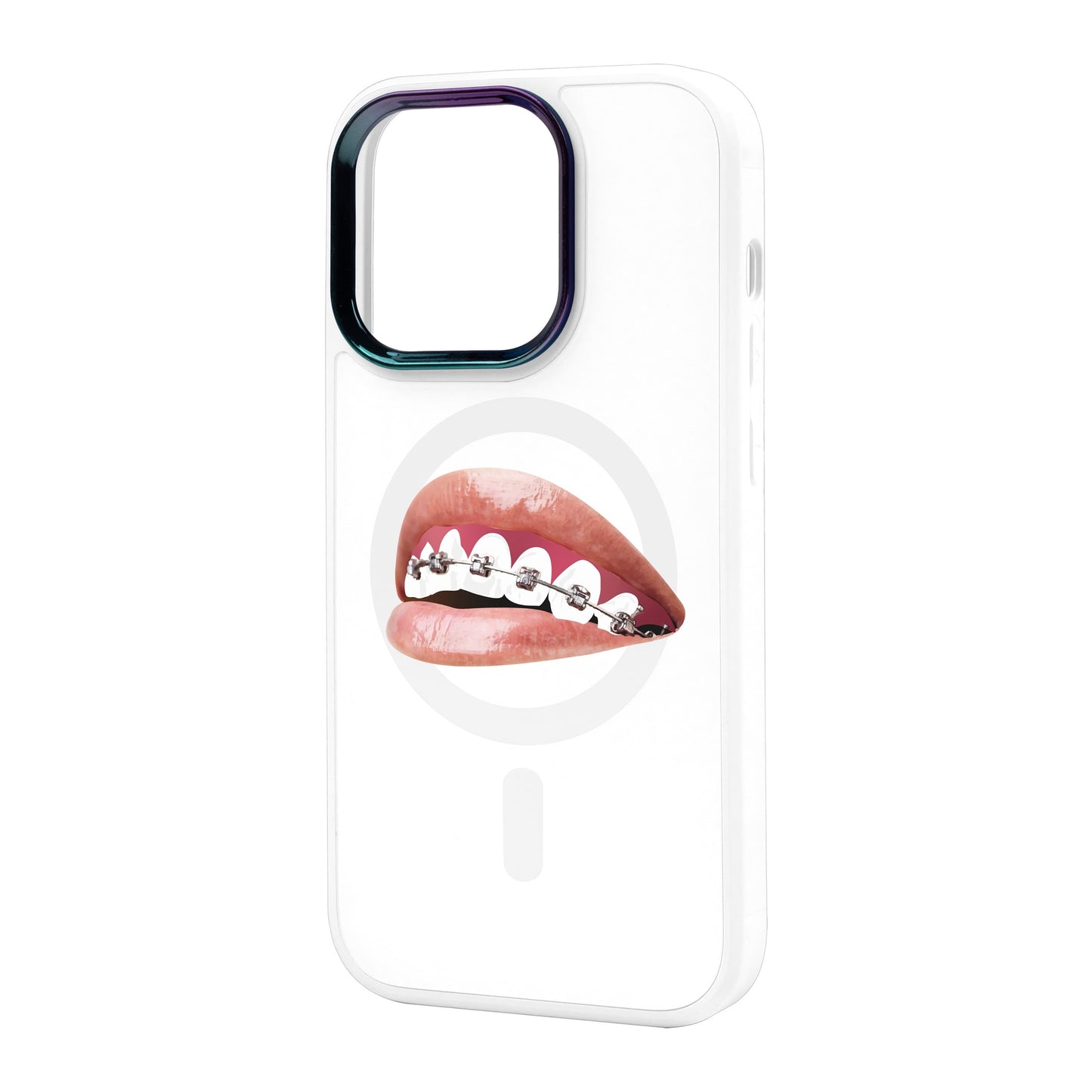 ORTHODONTİST-iPhone 14 Pro Max Vigor Kılıf MagSafe Özellikli
