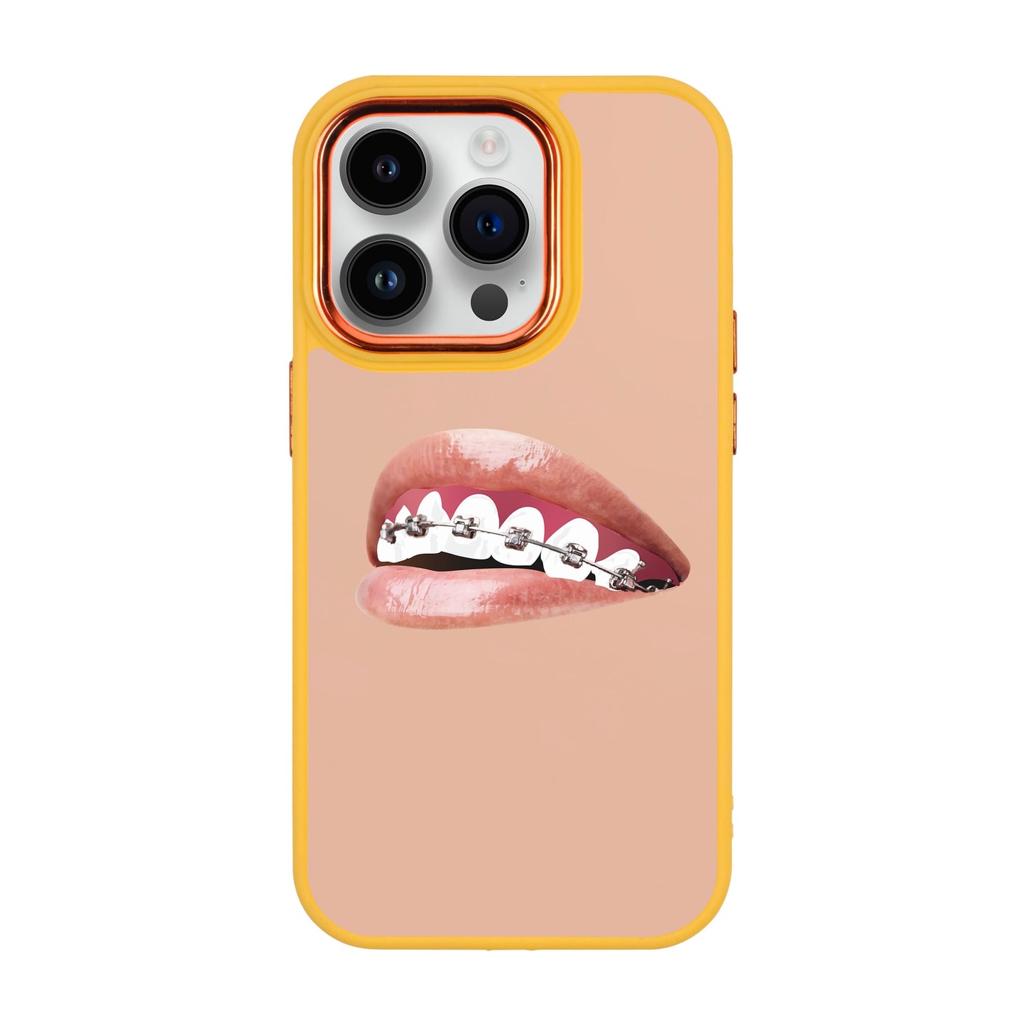ORTHODONTIST-iPhone 14 Pro Proof Kılıf