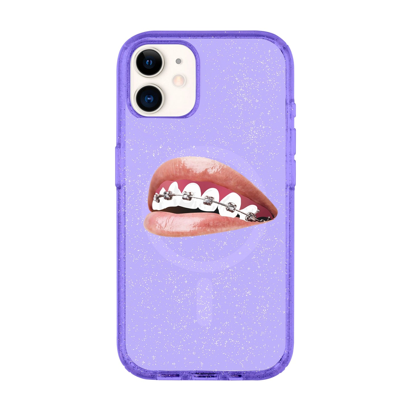 ORTHODONTIST-iPhone 11 Shiny Kılıf MagSafe Özellikli