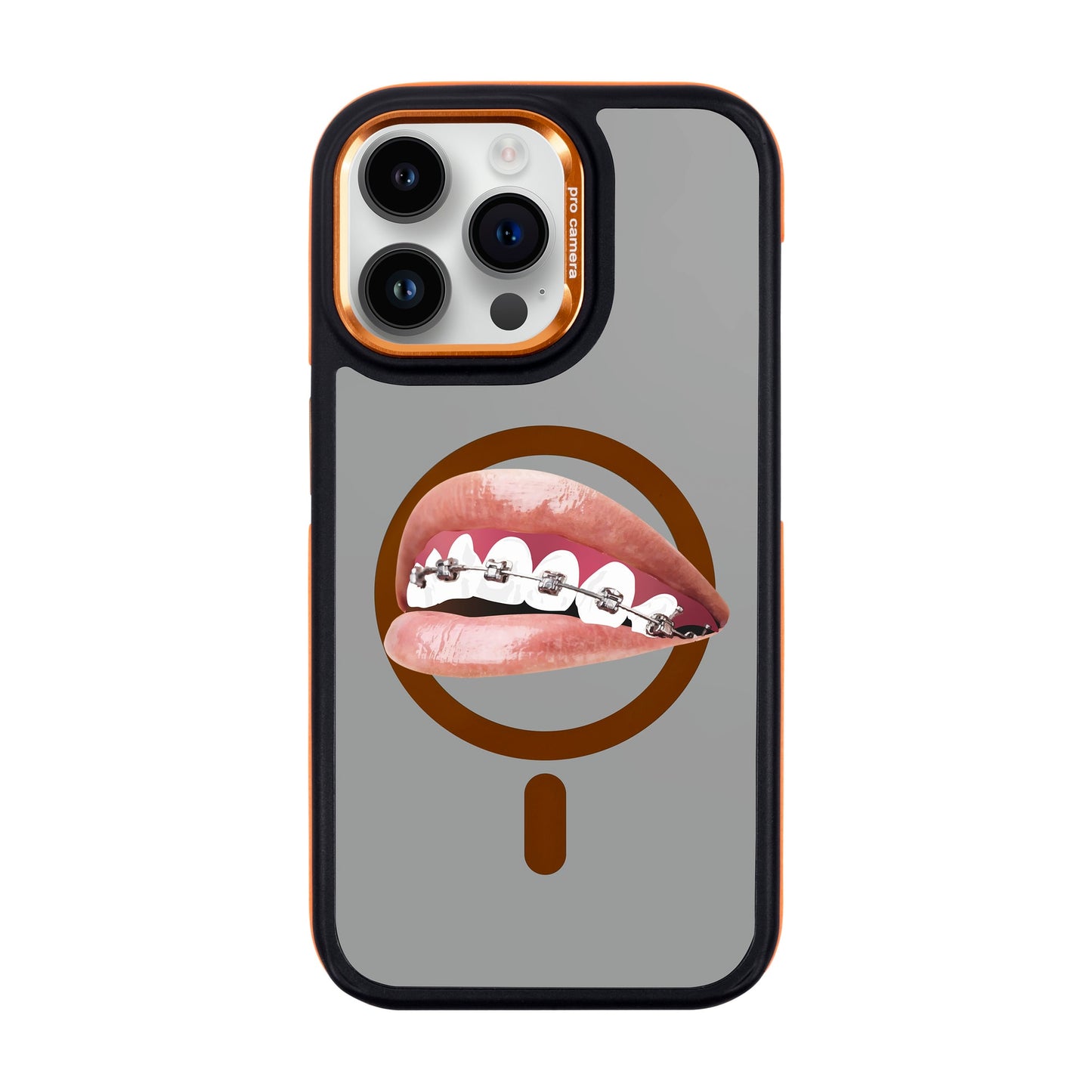 ORTHODONTIST-iPhone 14 Pro Max Dark Kılıf MagSafe Özellikli