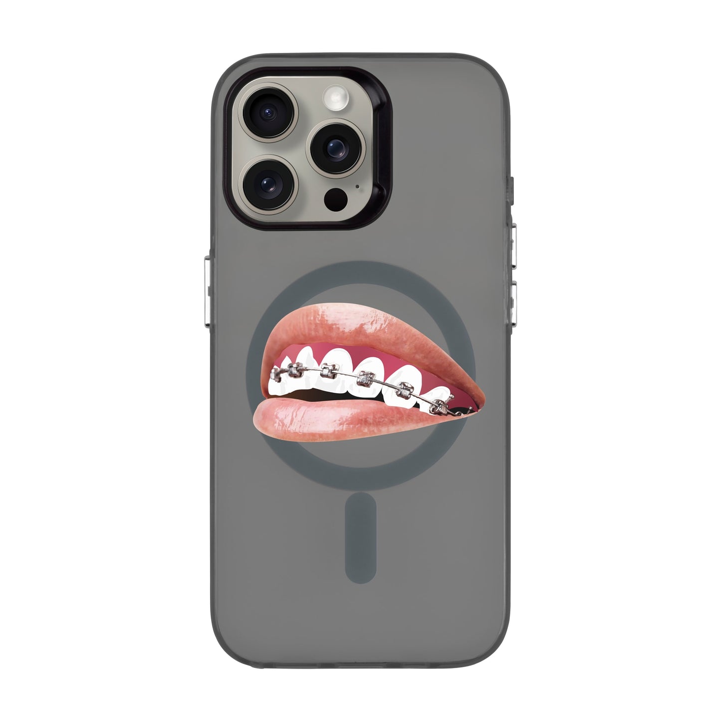 ORTHODONTIST-iPhone 15 Pro Max Hold Kılıf MagSafe Özellikli