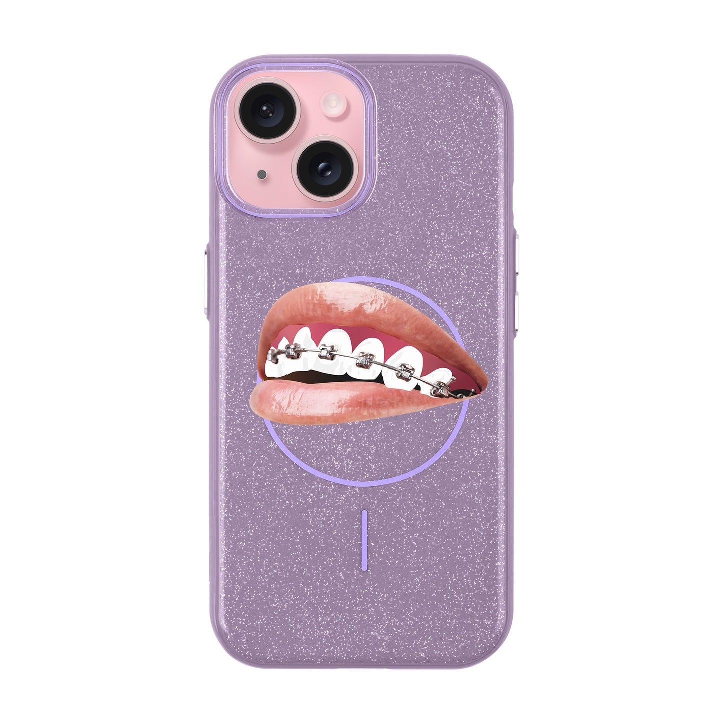 ORTHODONTIST-iPhone 15 Plus Radiant Kılıf MagSafe Özellikli
