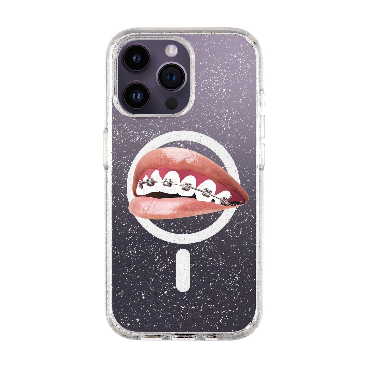 ORTHODONTIST-iPhone 14 Pro Max Shiny Kılıf MagSafe Özellikli