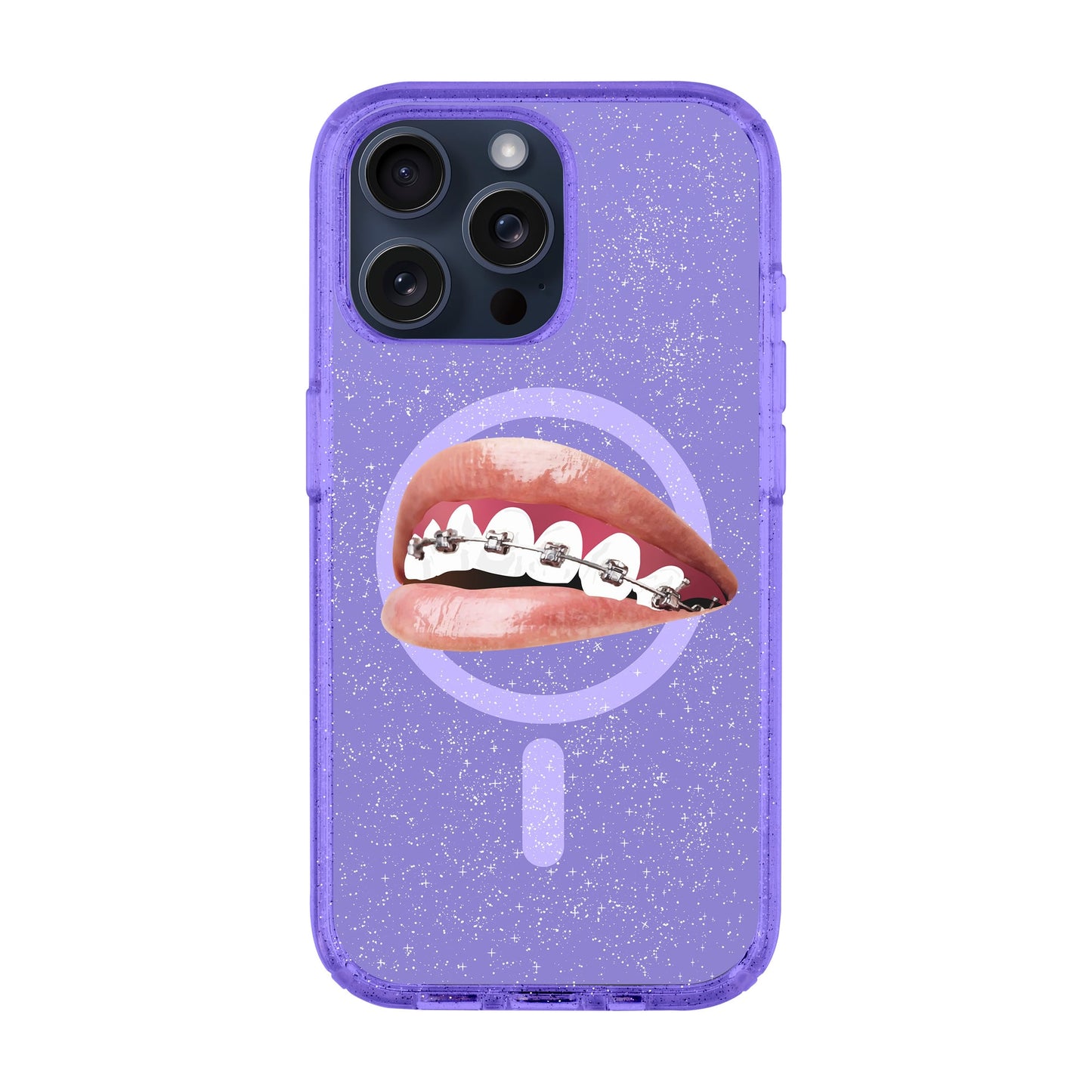 ORTHODONTIST-iPhone 15 Pro Max Shiny Kılıf MagSafe Özellikli