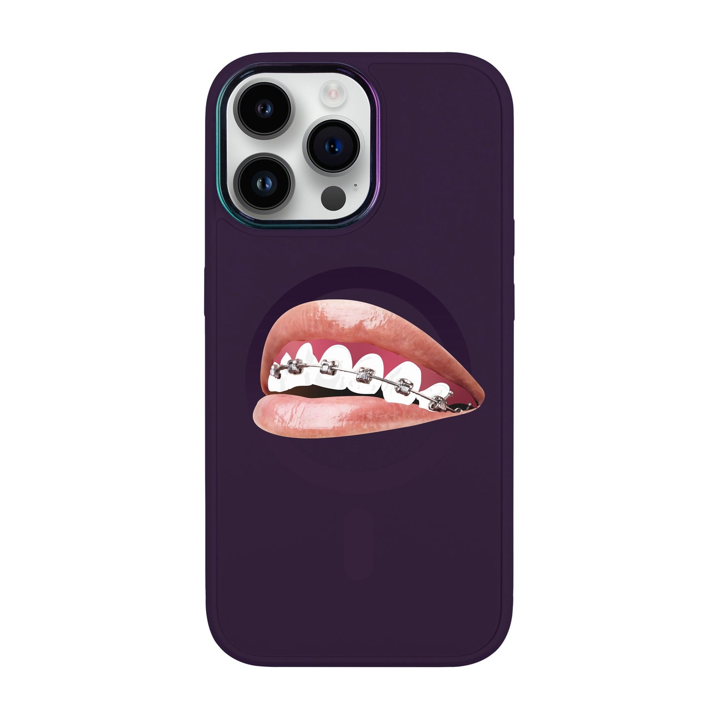 ORTHODONTİST-iPhone 14 Pro Max Vigor Kılıf MagSafe Özellikli