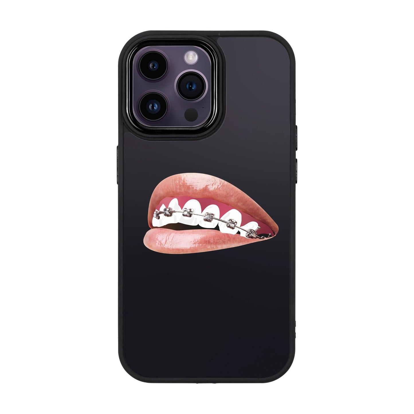 ORTHODONTIST-iPhone 14 Pro Max Proof Kılıf