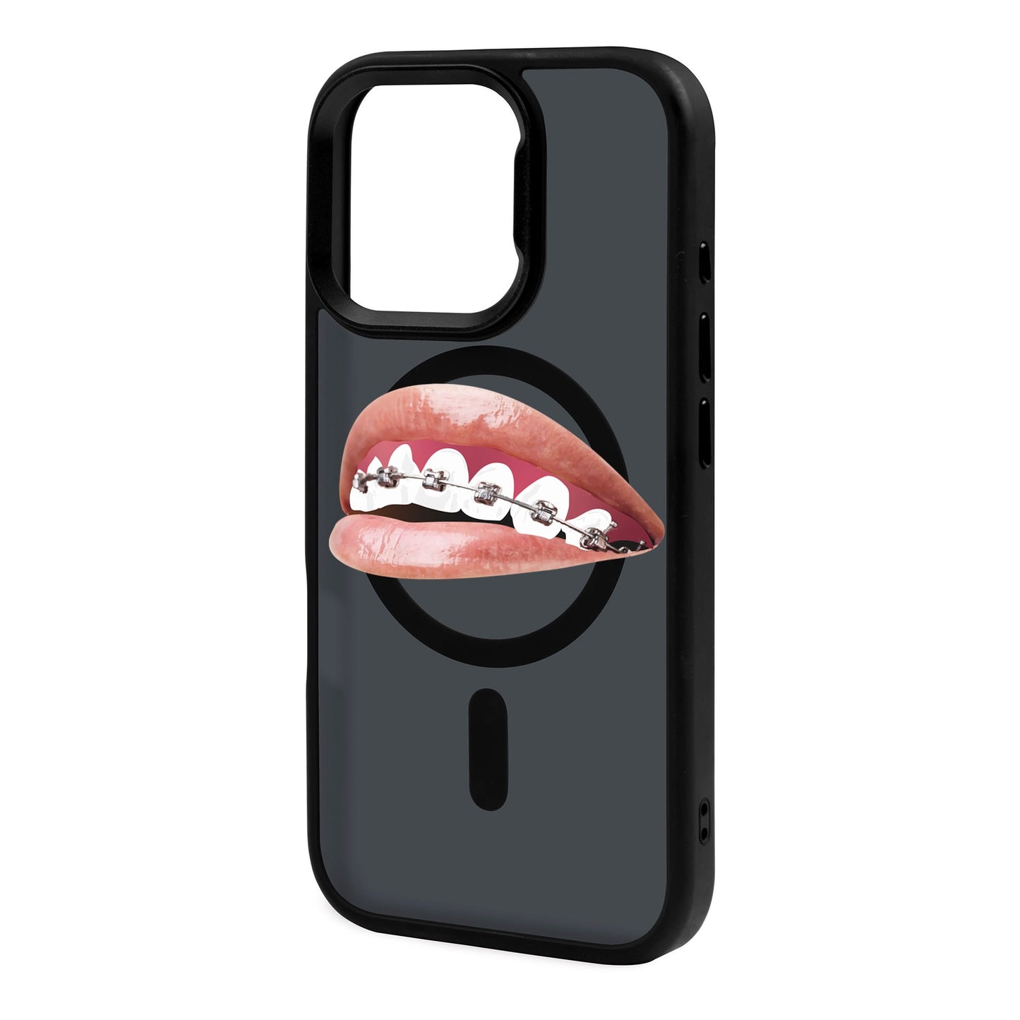 ORTHODONTIST-iPhone 16 Pro Rise Kılıf MagSafe Özellikli