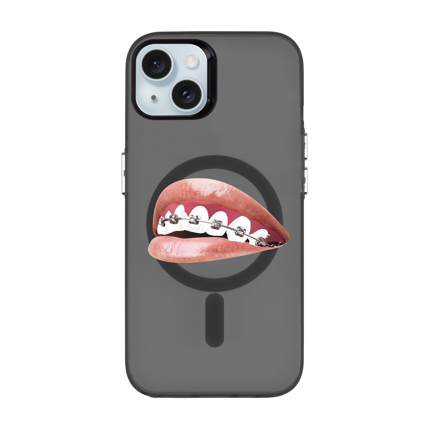 ORTHODONTIST-iPhone 15 Plus Hold Kılıf MagSafe Özellikli