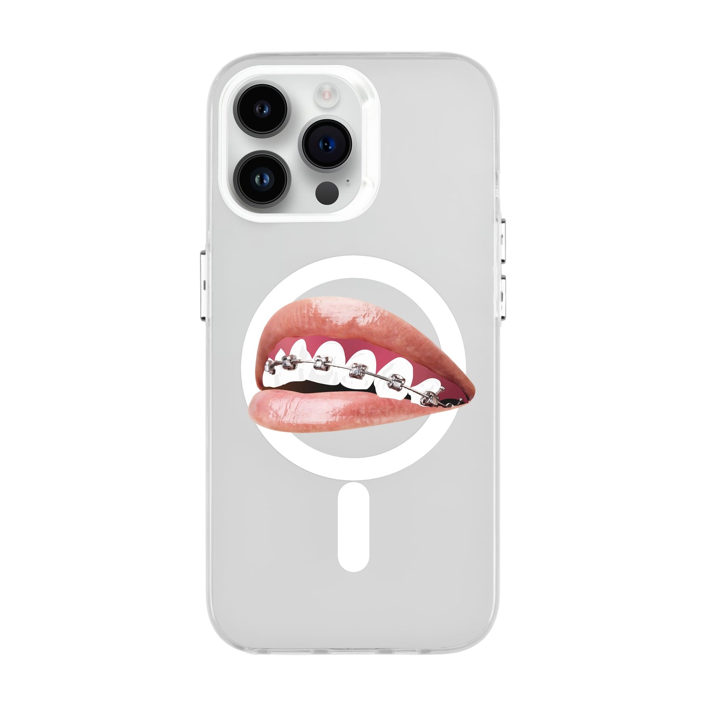 ORTHODONTIST-iPhone 14 Pro Max Hold Kılıf MagSafe Özellikli
