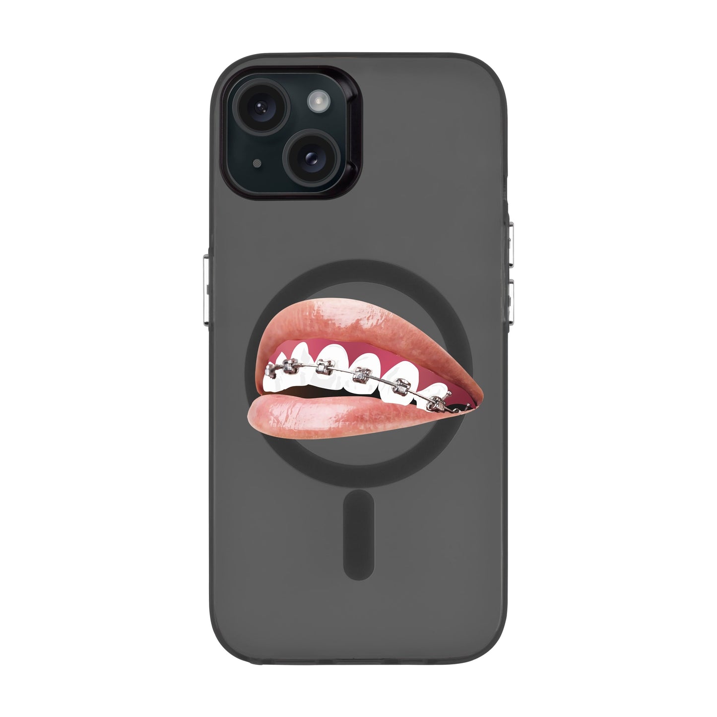 ORTHODONTIST-iPhone 15 Plus Hold Kılıf MagSafe Özellikli
