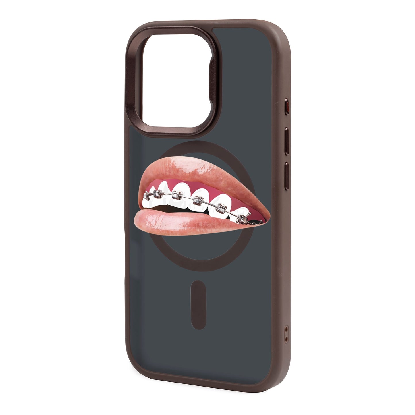 ORTHODONTIST-iPhone 16 Pro Rise Kılıf MagSafe Özellikli