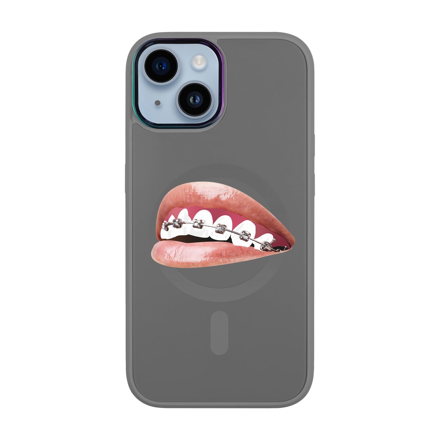 ORTHODONTİST-iPhone 12 Vigor Kılıf MagSafe Özellikli