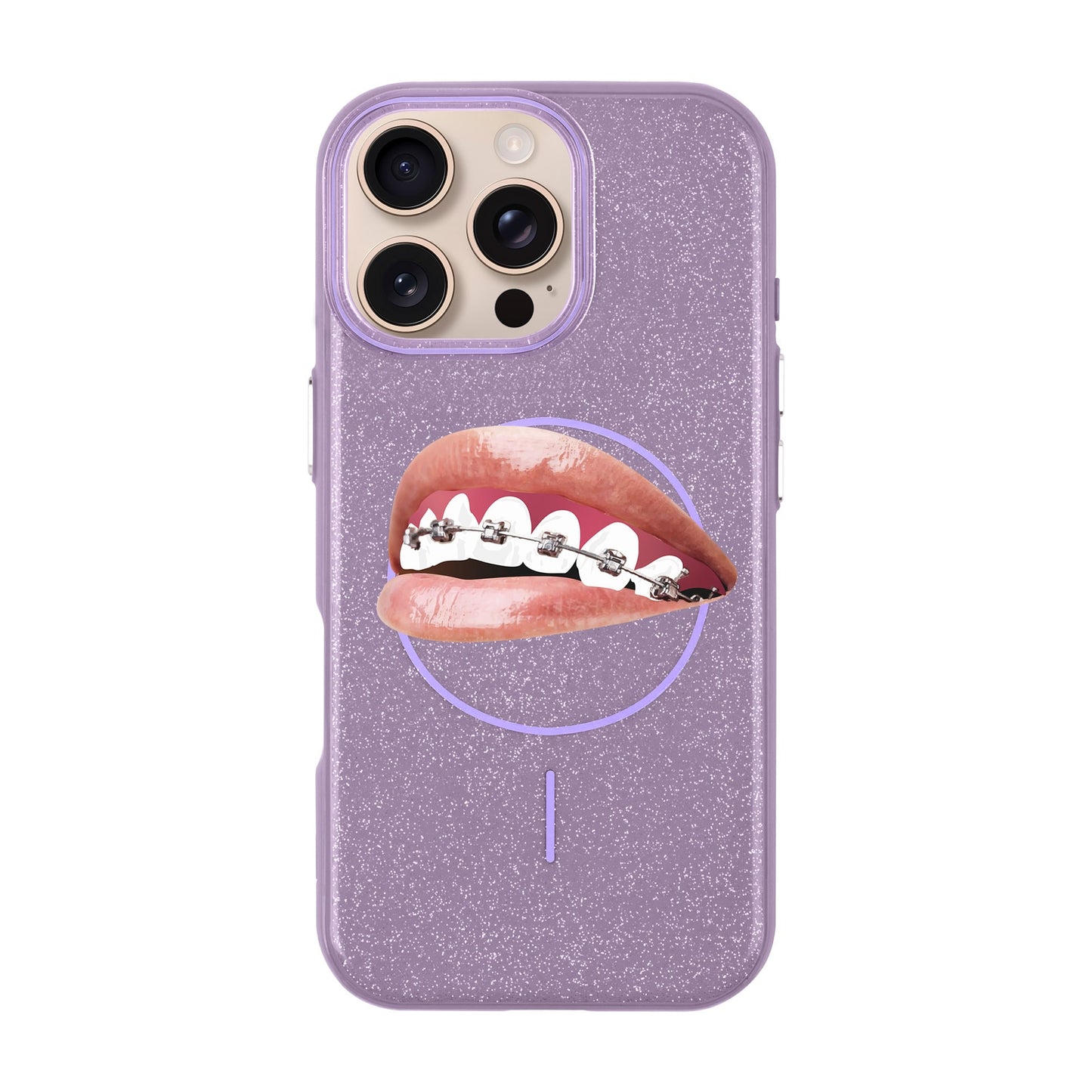 ORTHODONTIST-iPhone 16 Pro Max Radiant Kılıf MagSafe Özellikli