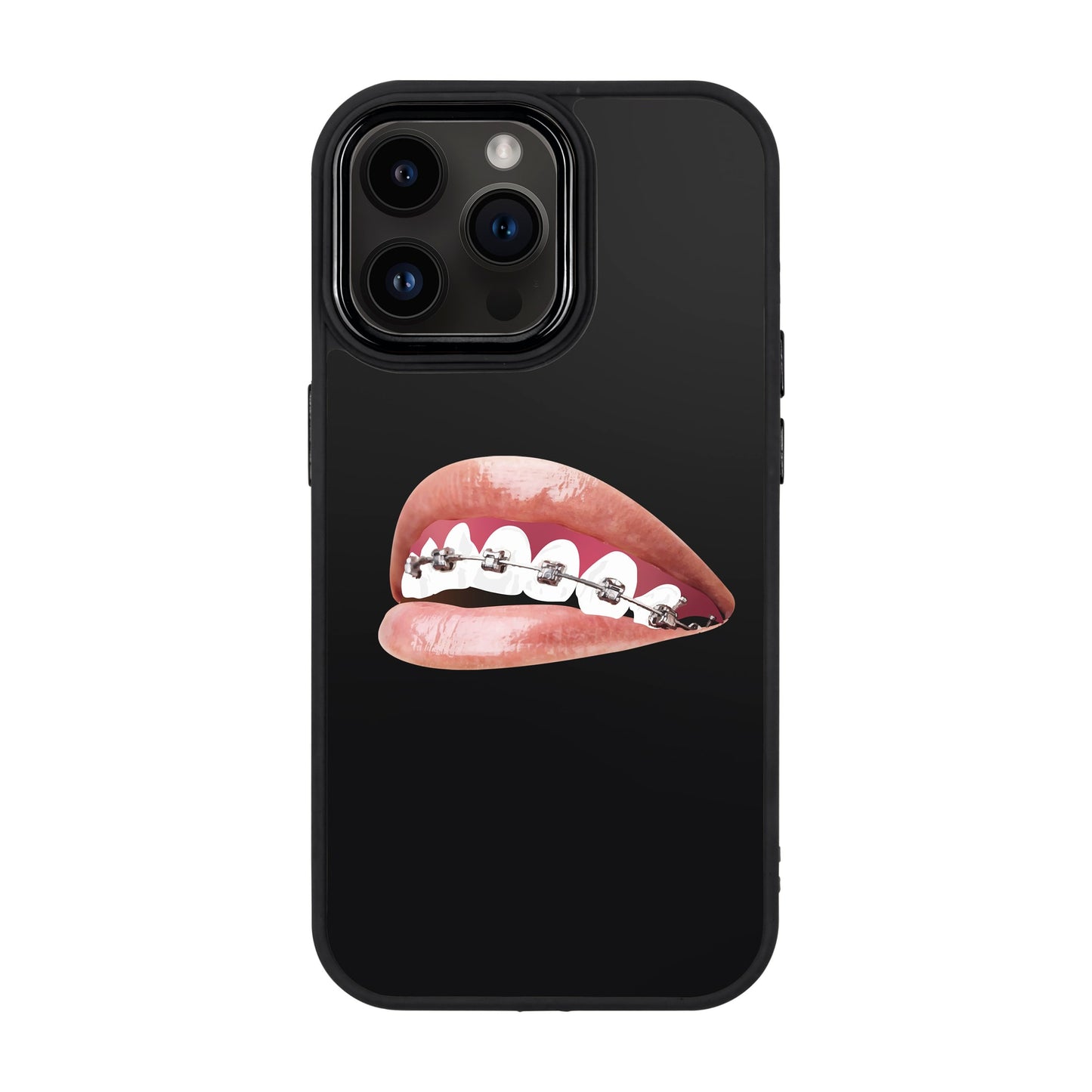 ORTHODONTIST-iPhone 14 Pro Max Proof Kılıf